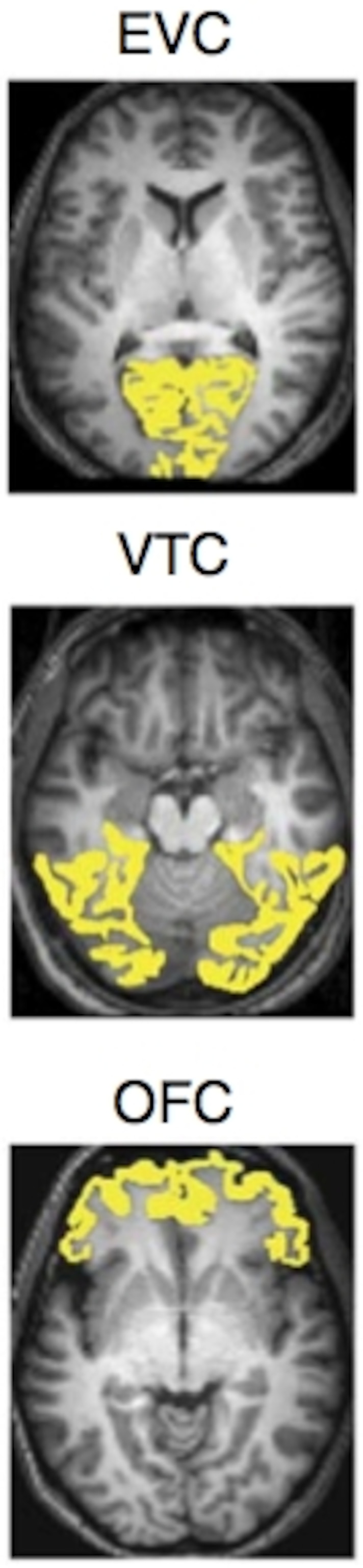 Chikazoe et al, Nature Neuroscience 2014