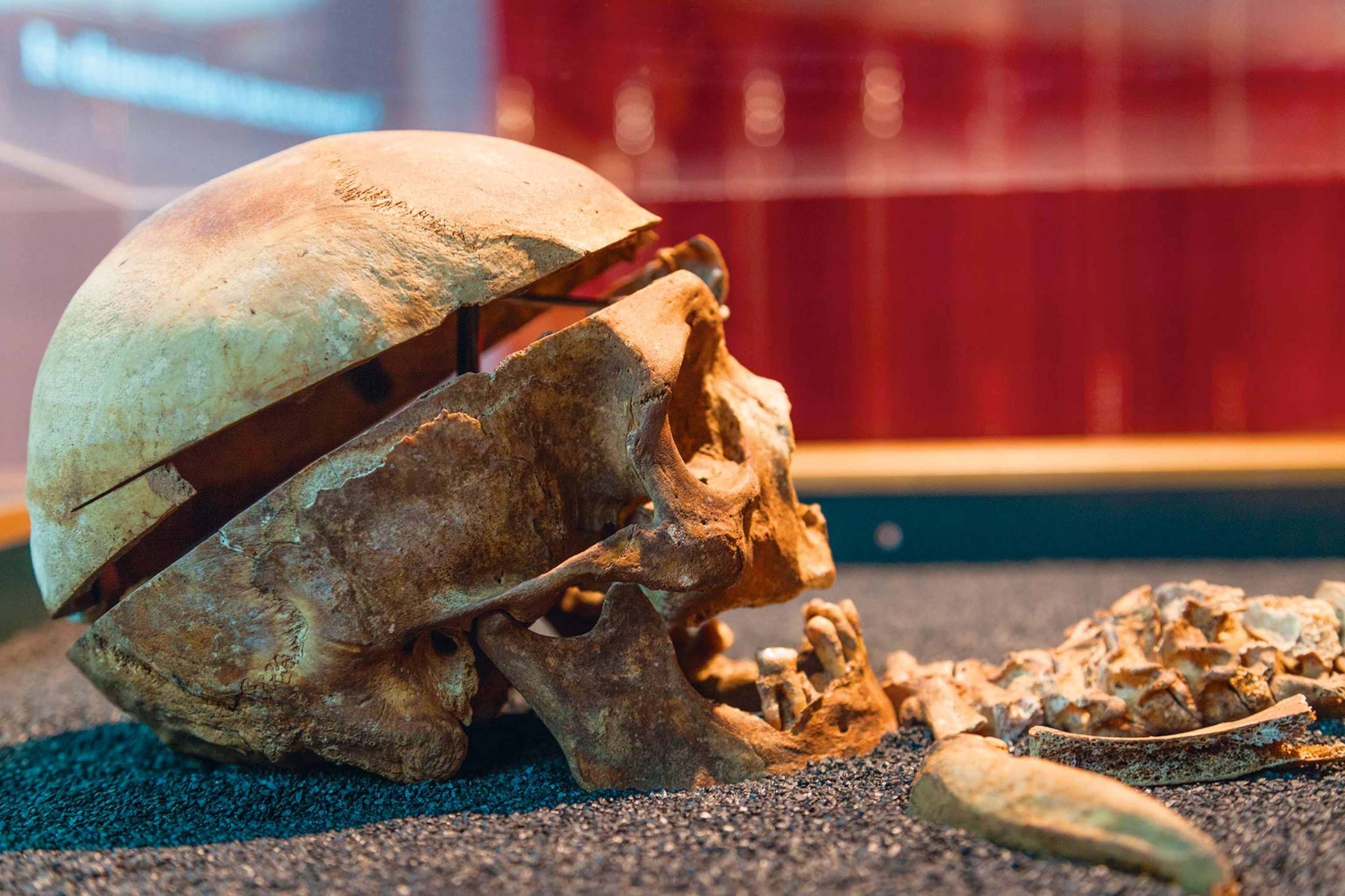 Side view of a skull with evidence of medical dissection