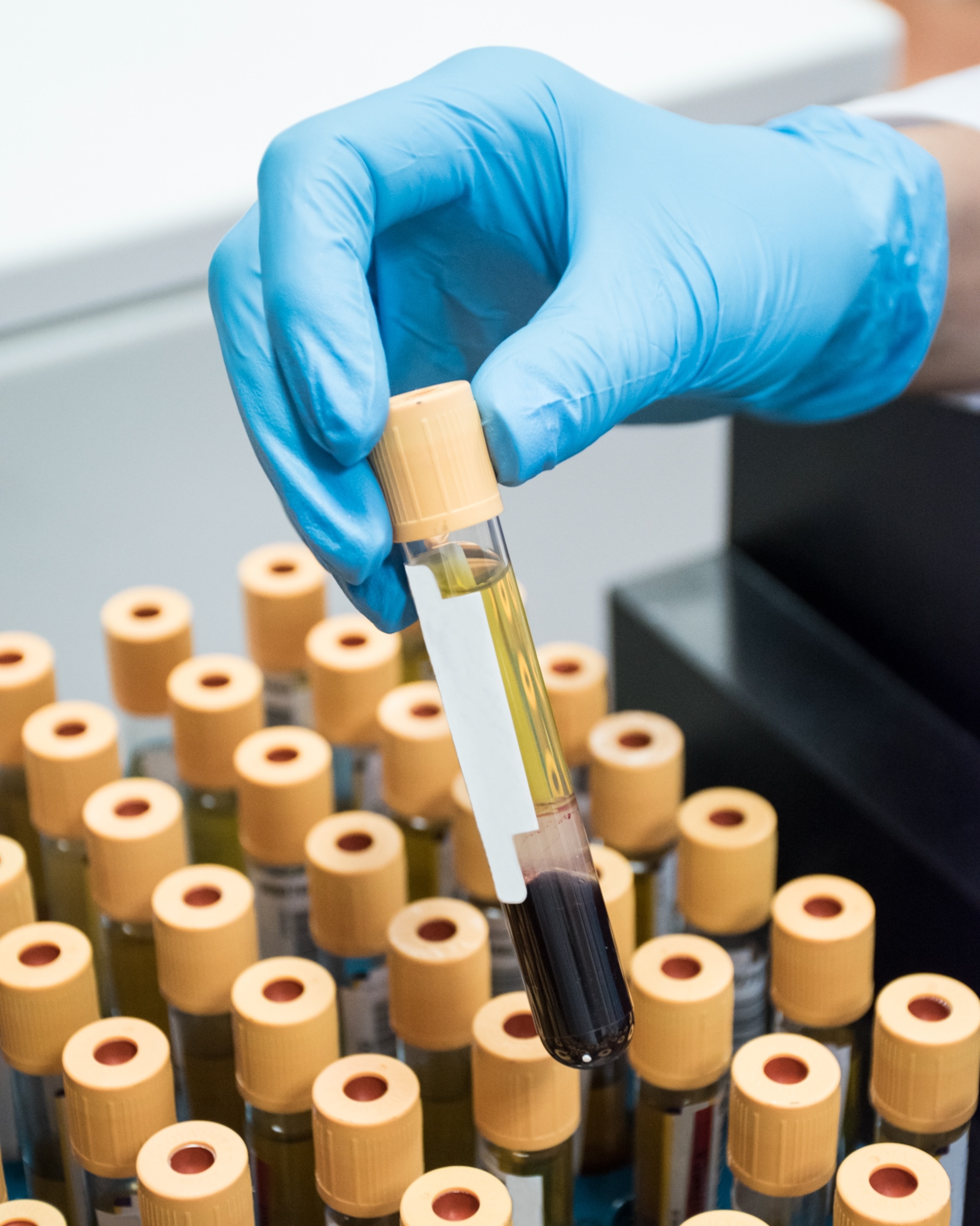 A gloved hand holds a test tube of blood above rows of similar tubes