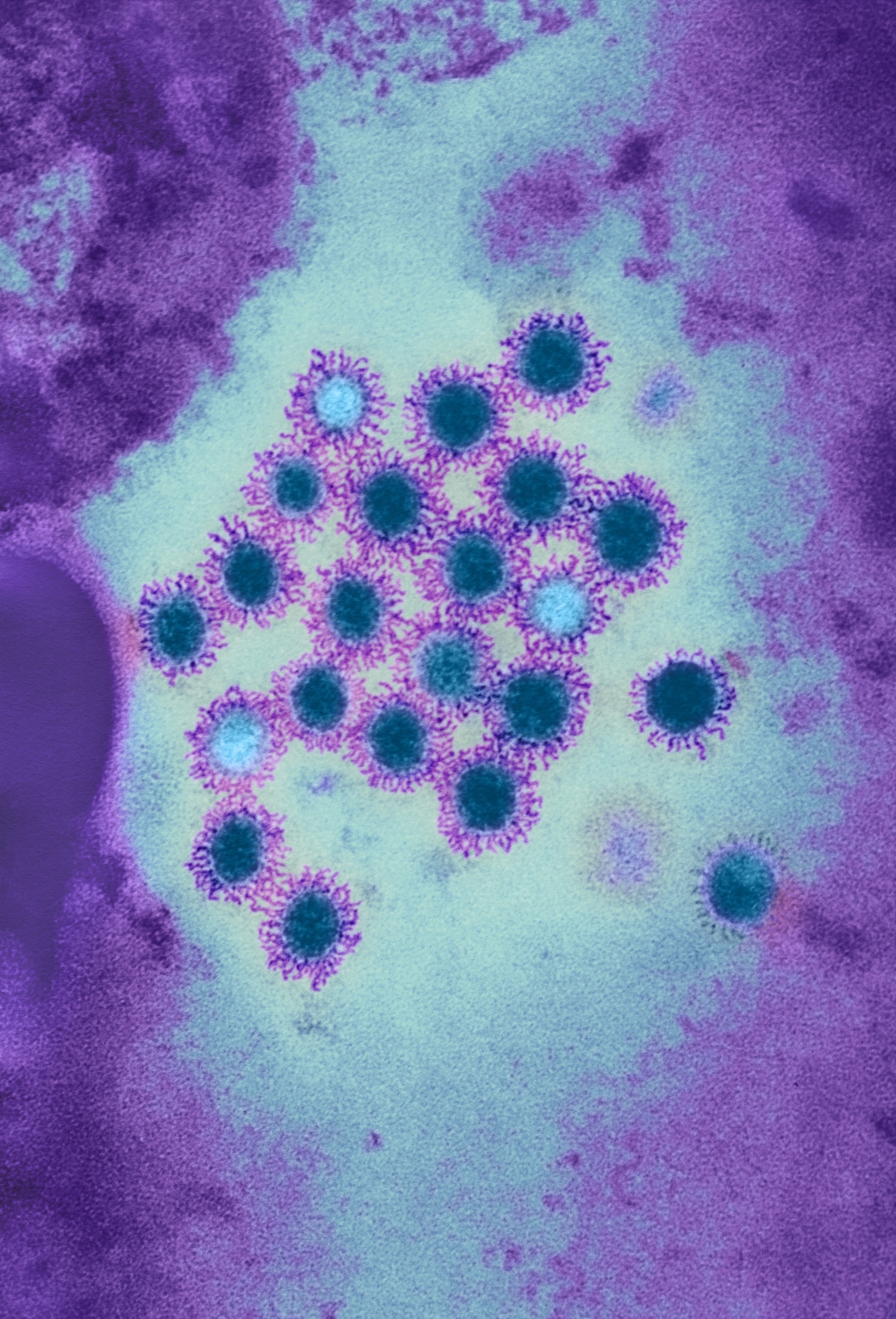 Electron microscope image of virus particles. They appear as dark blue spheres with spiky purple edges.