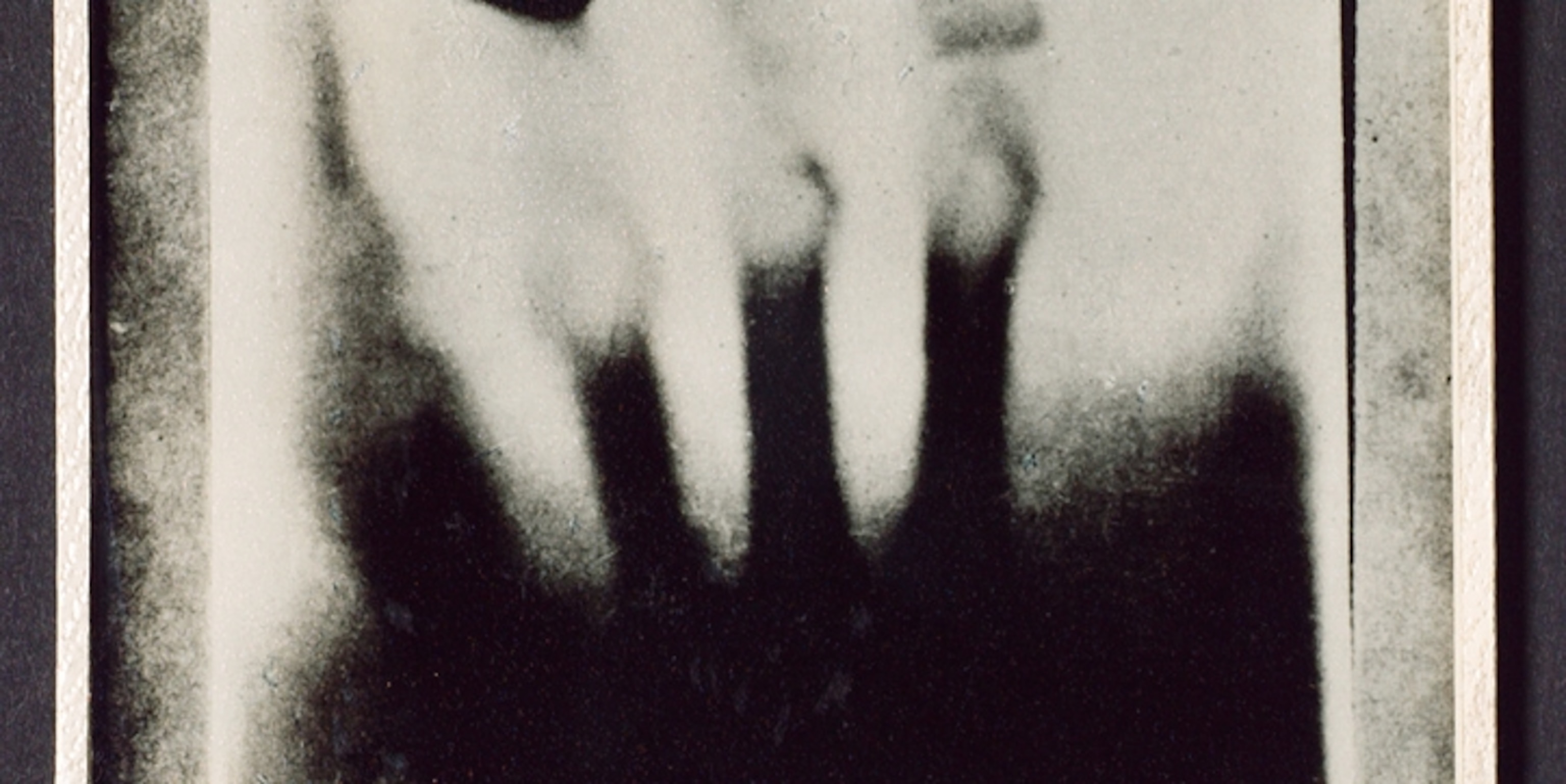 Photos X Ray History Hidden Kittens Quackery And More