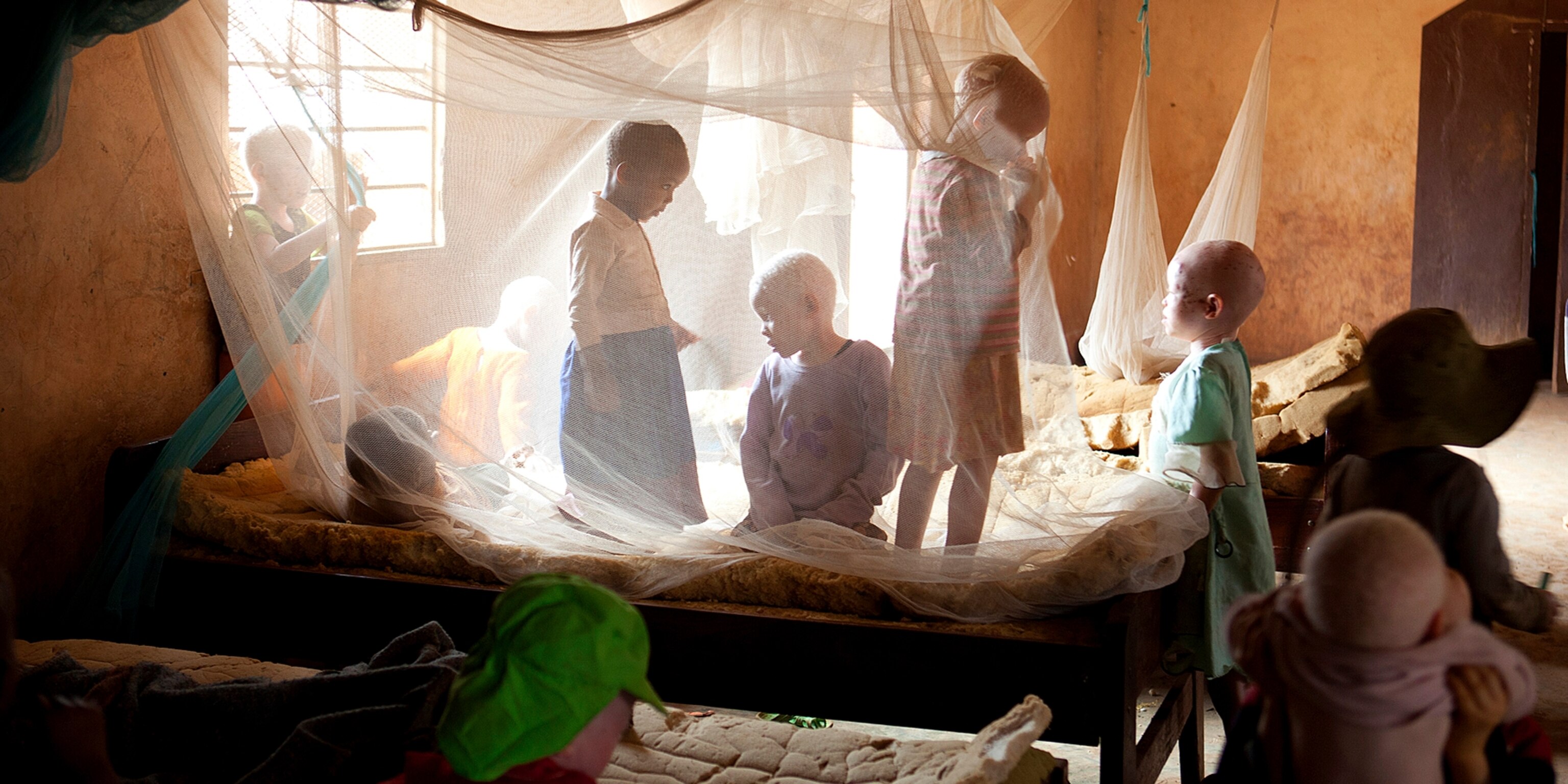 As Tanzania S Albino Killings Continue Unanswered Questions Raise Fears