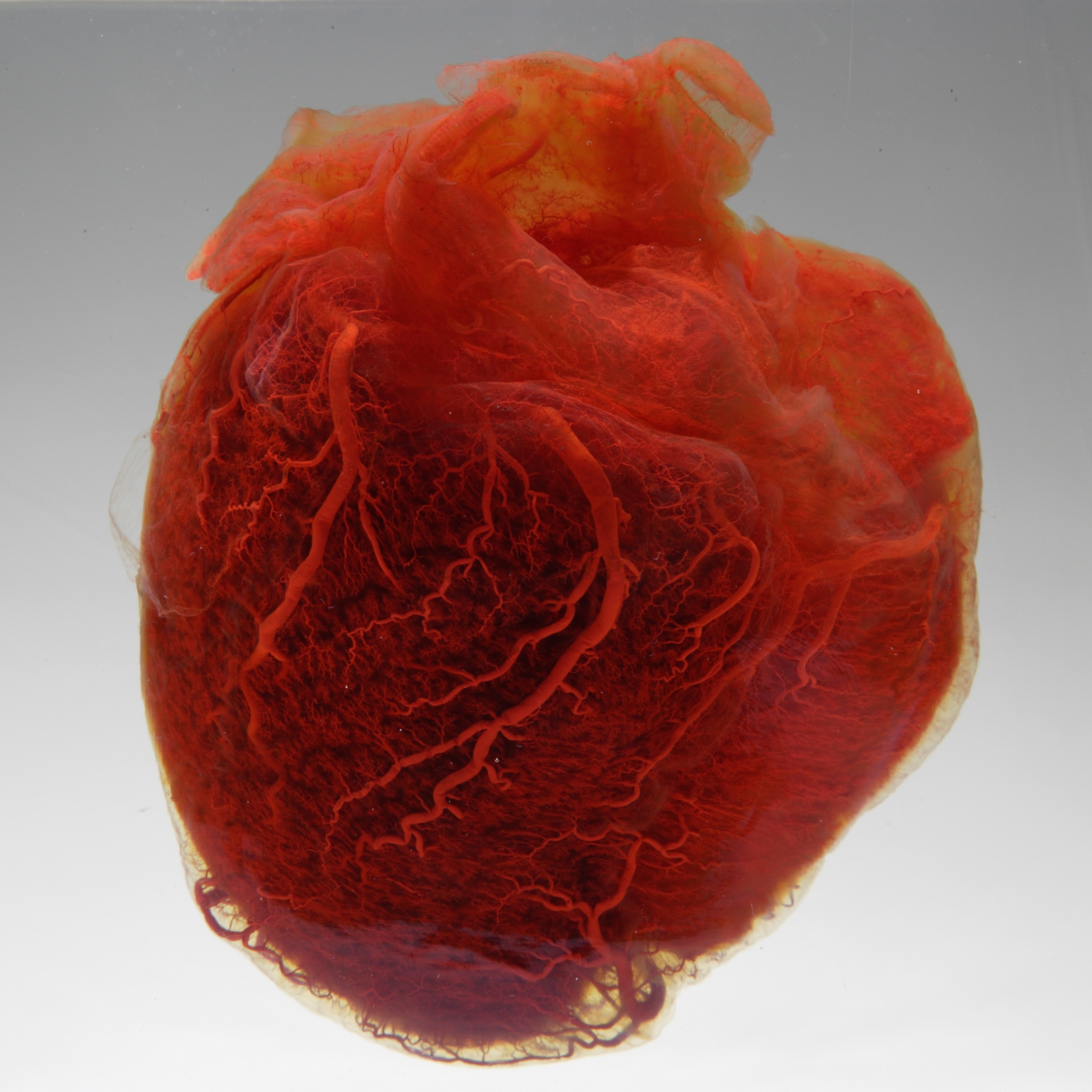 In a first, microplastic particles have been linked to heart disease