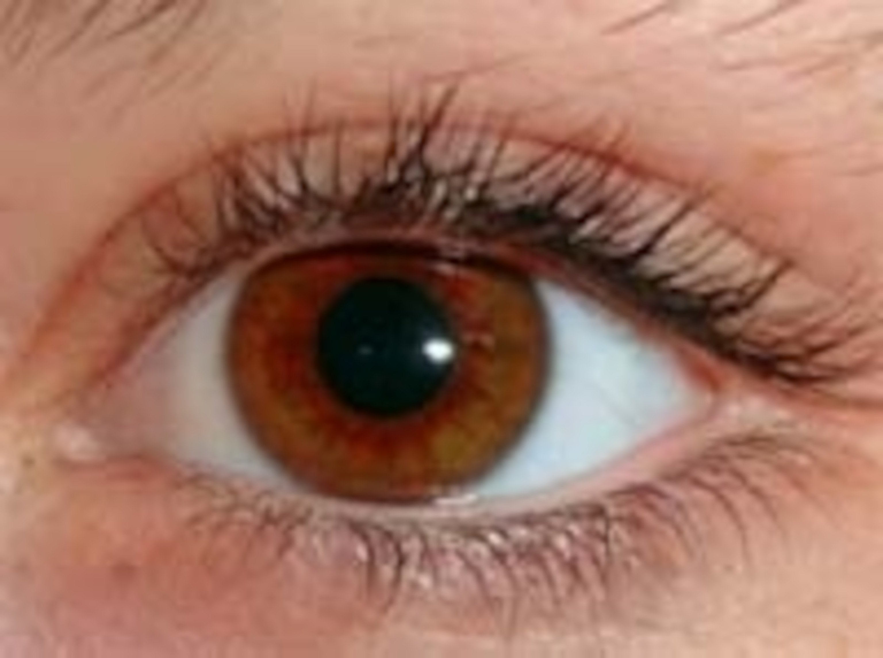 Eye.jpg