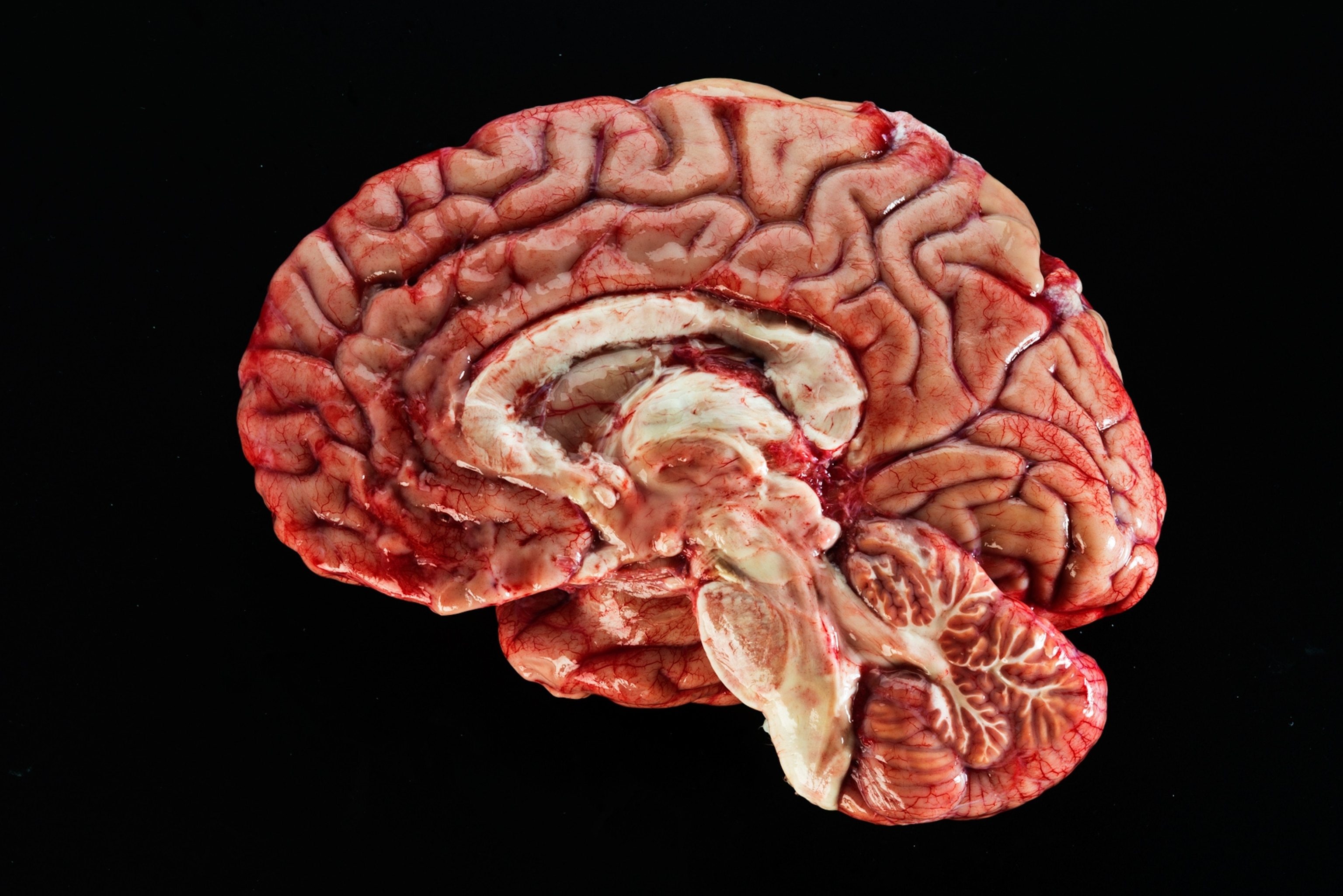 a cross-section of the human brain