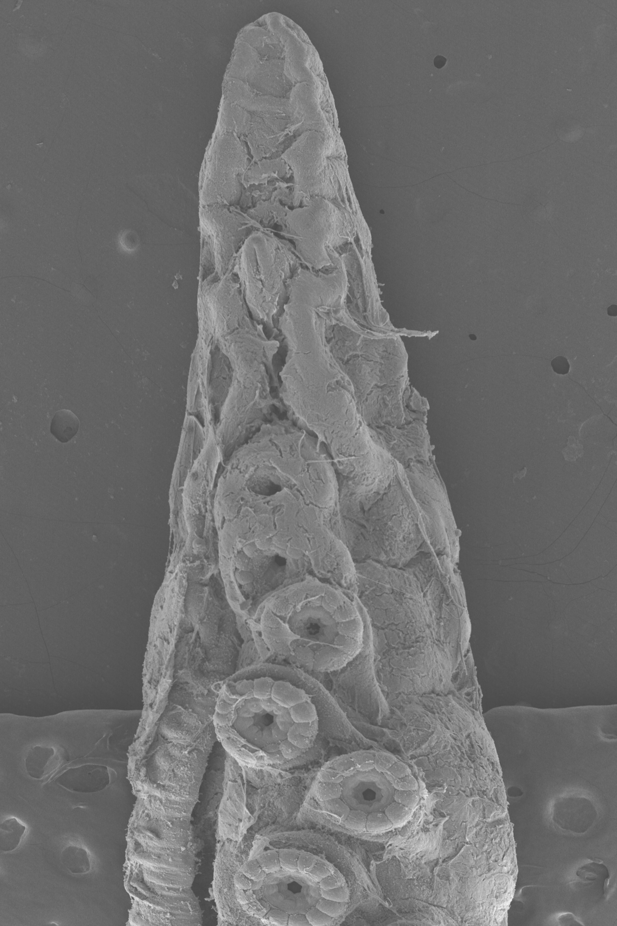Scanning electron microscopy image of the hectocotylus