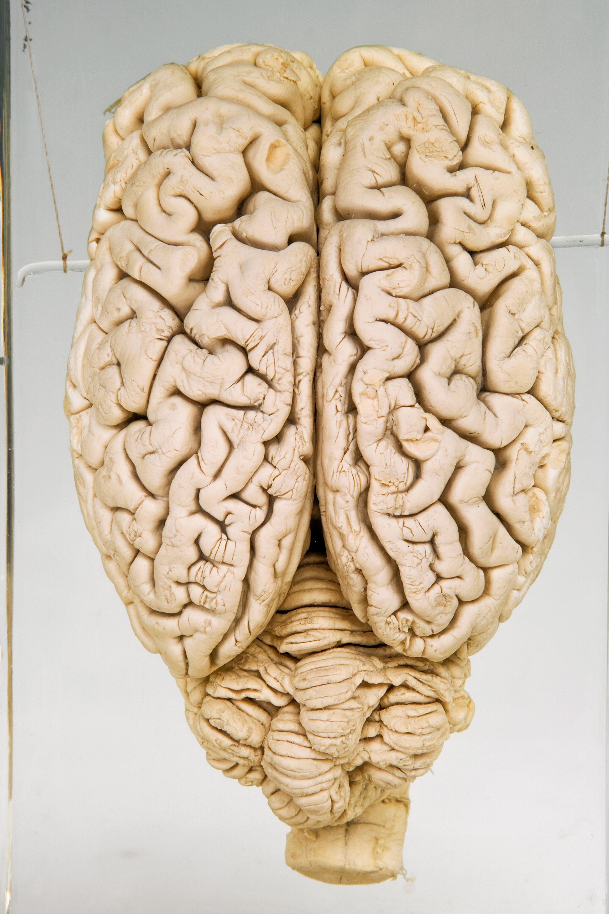 Pig Brains Partially Revived Hours After Death What It Means For People