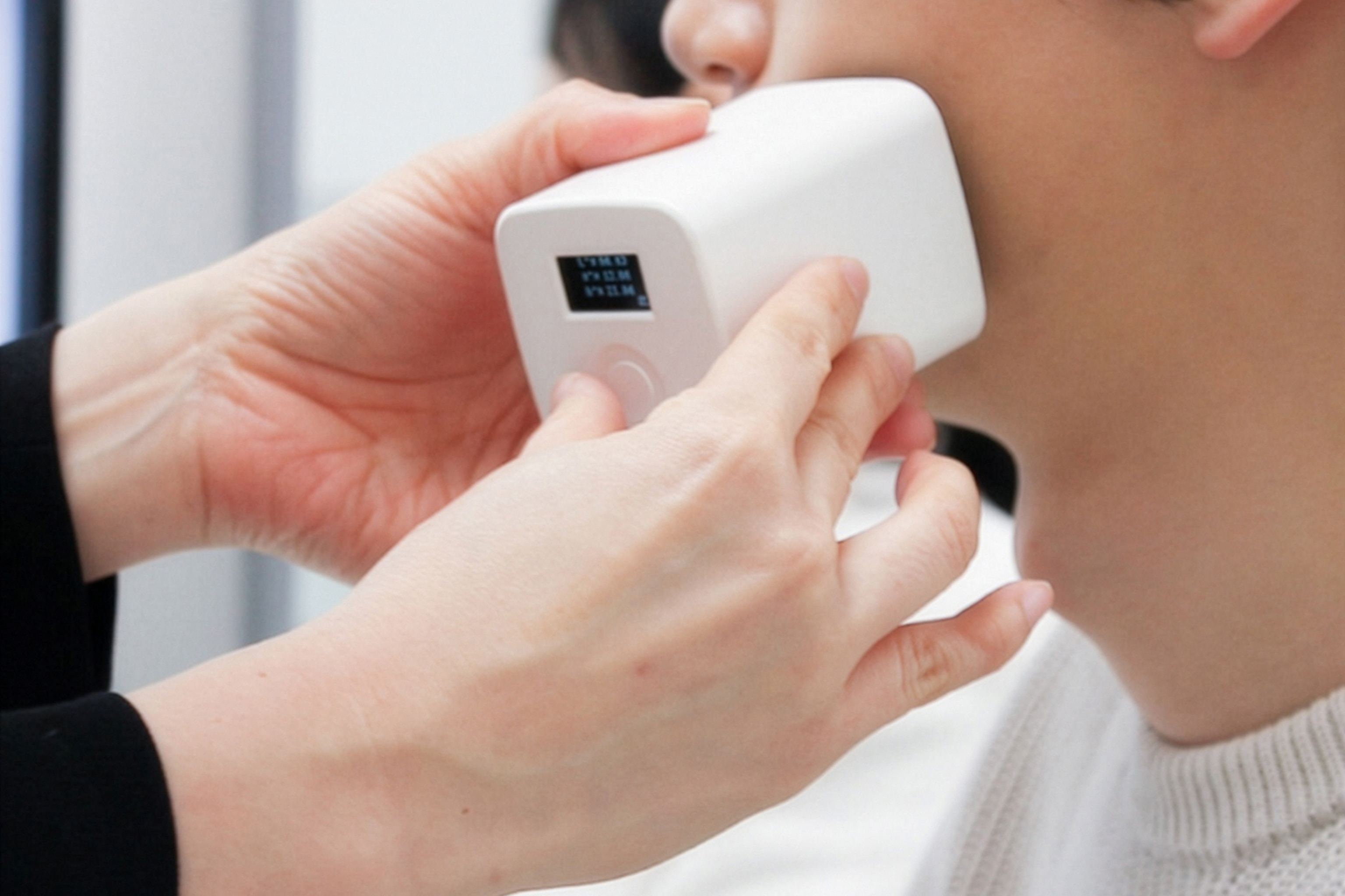 skincare analysis at a clinic