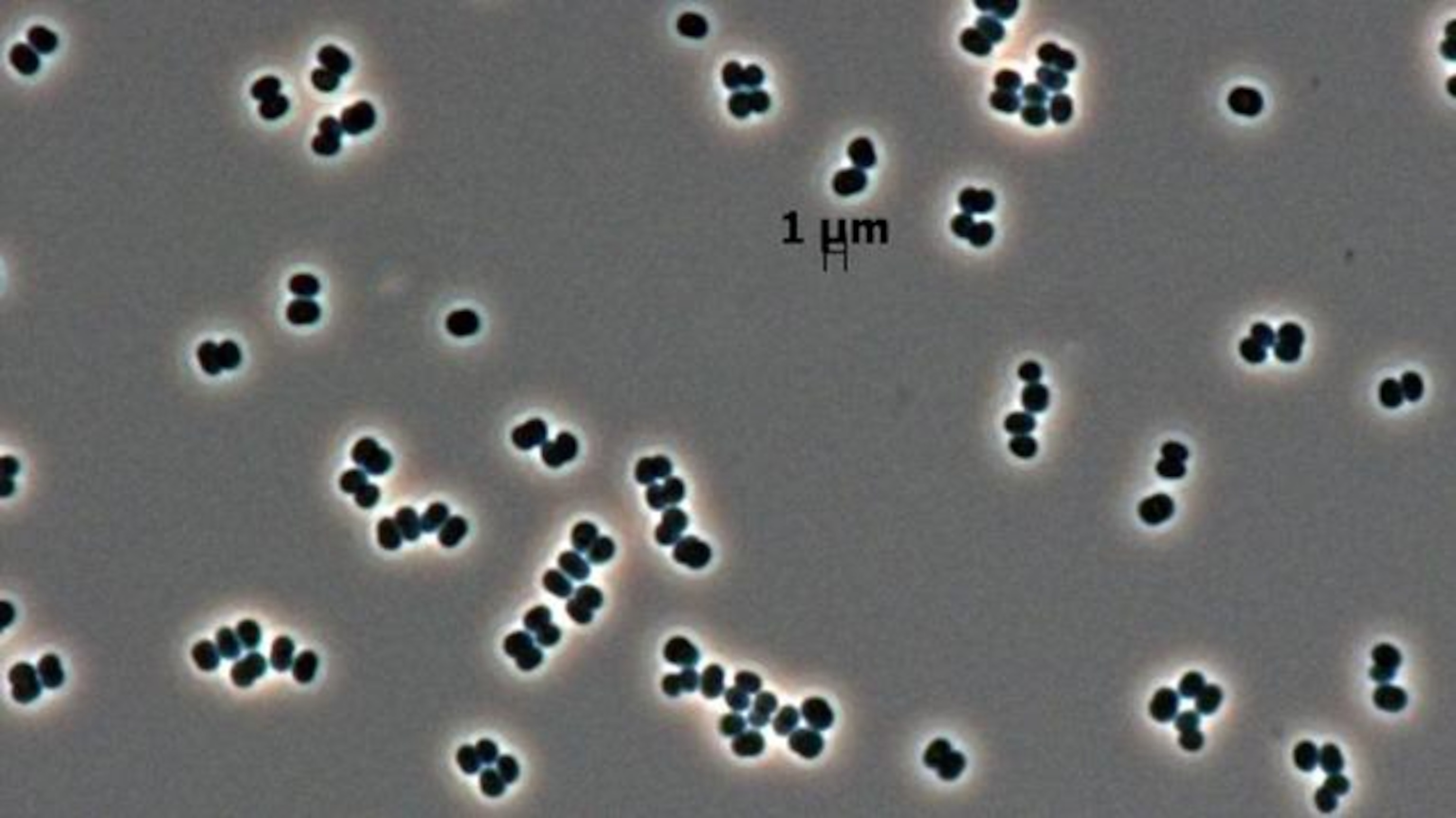 NASA discovered a bacteria that can 'play dead'—and might have