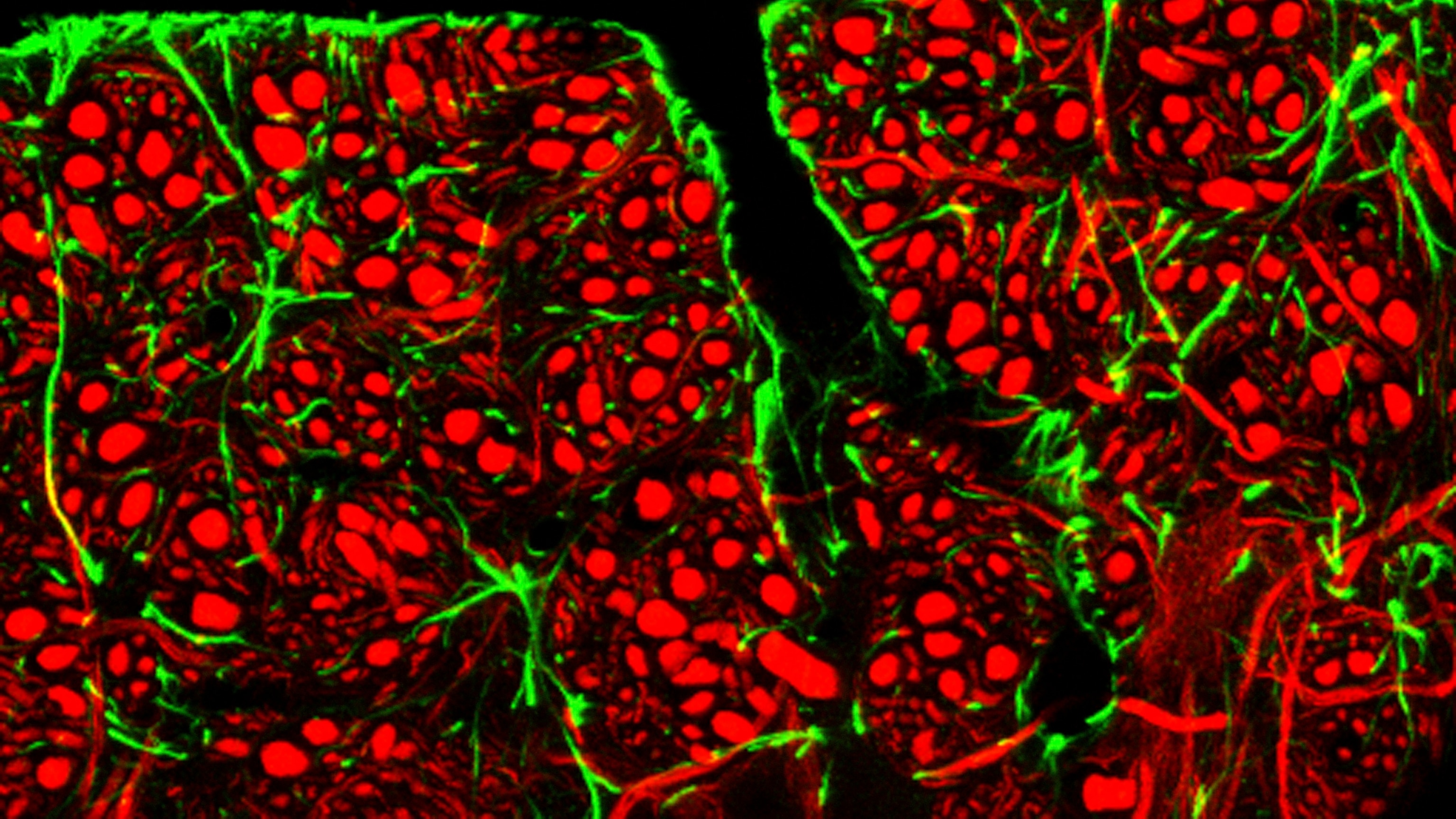 The Quest to Deliver Alzheimer's Drugs Directly to the Brain
