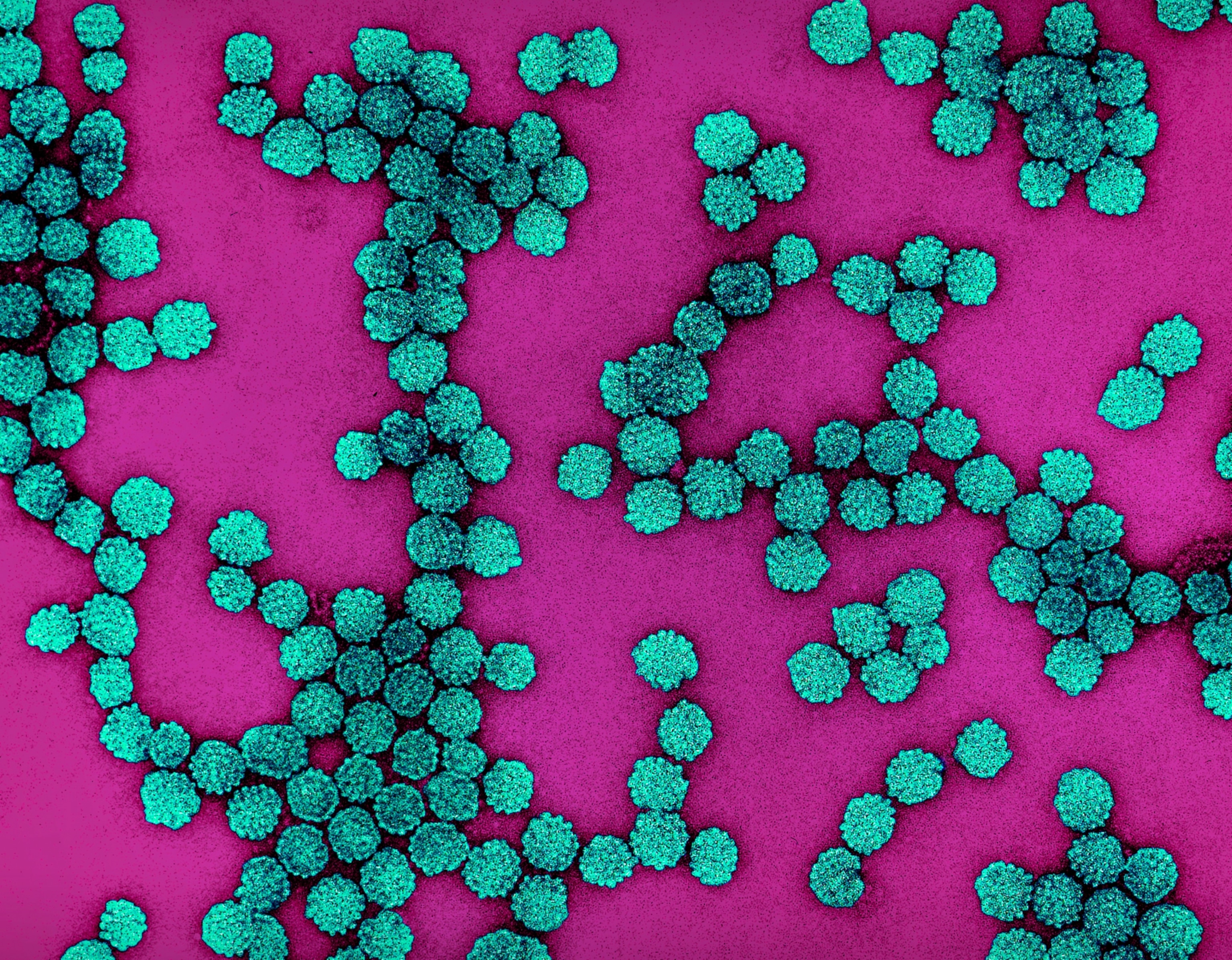 Microscopic view of vibrant turquoise virus clusters on a bright magenta background