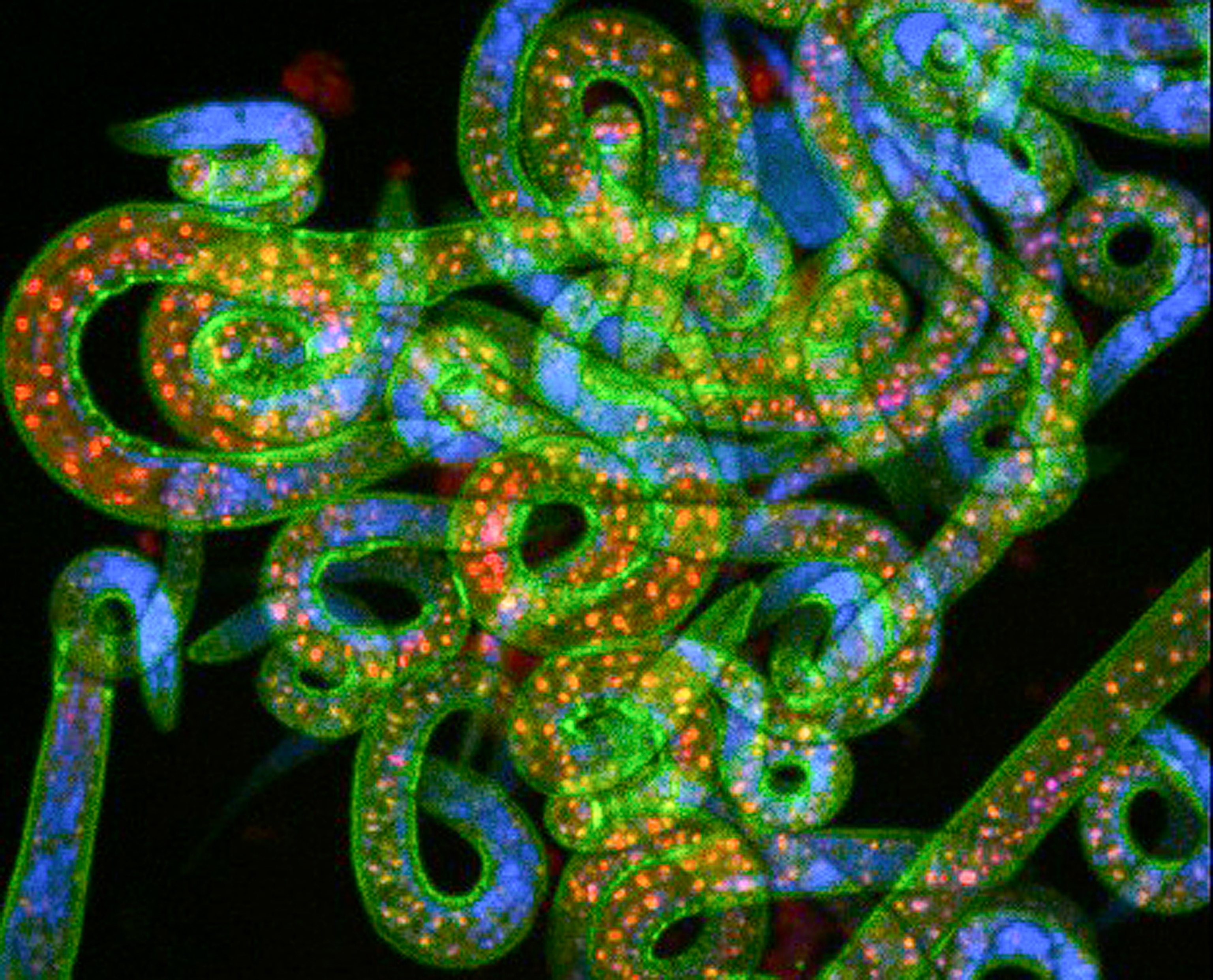Princeton Best Science Pictures - Picture of worms stained so that their DNA, in blue, and RNA, in red, are visible