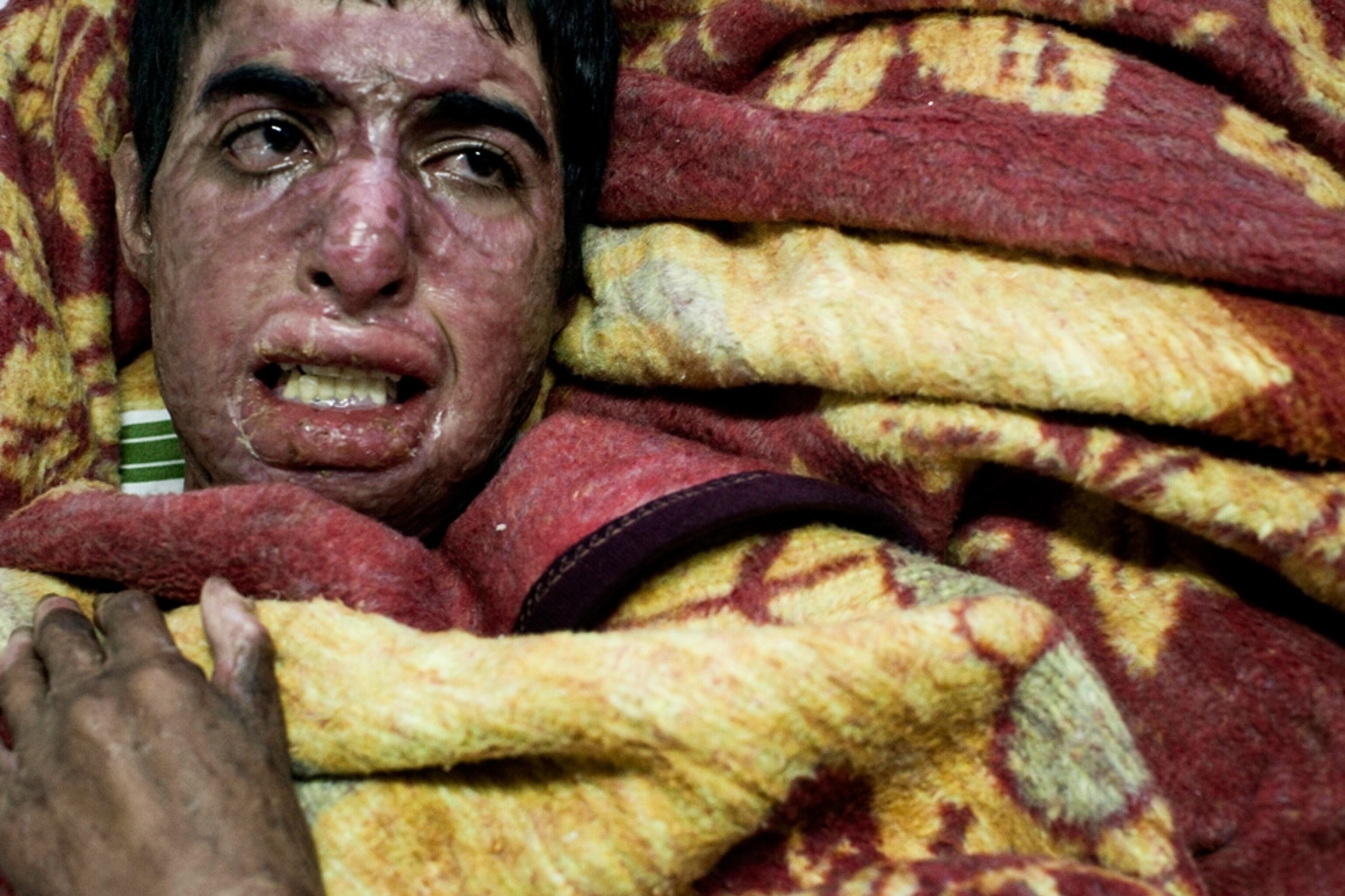 Libya picture: wounded fighter in the hospital -- for best pictures of October photo gallery