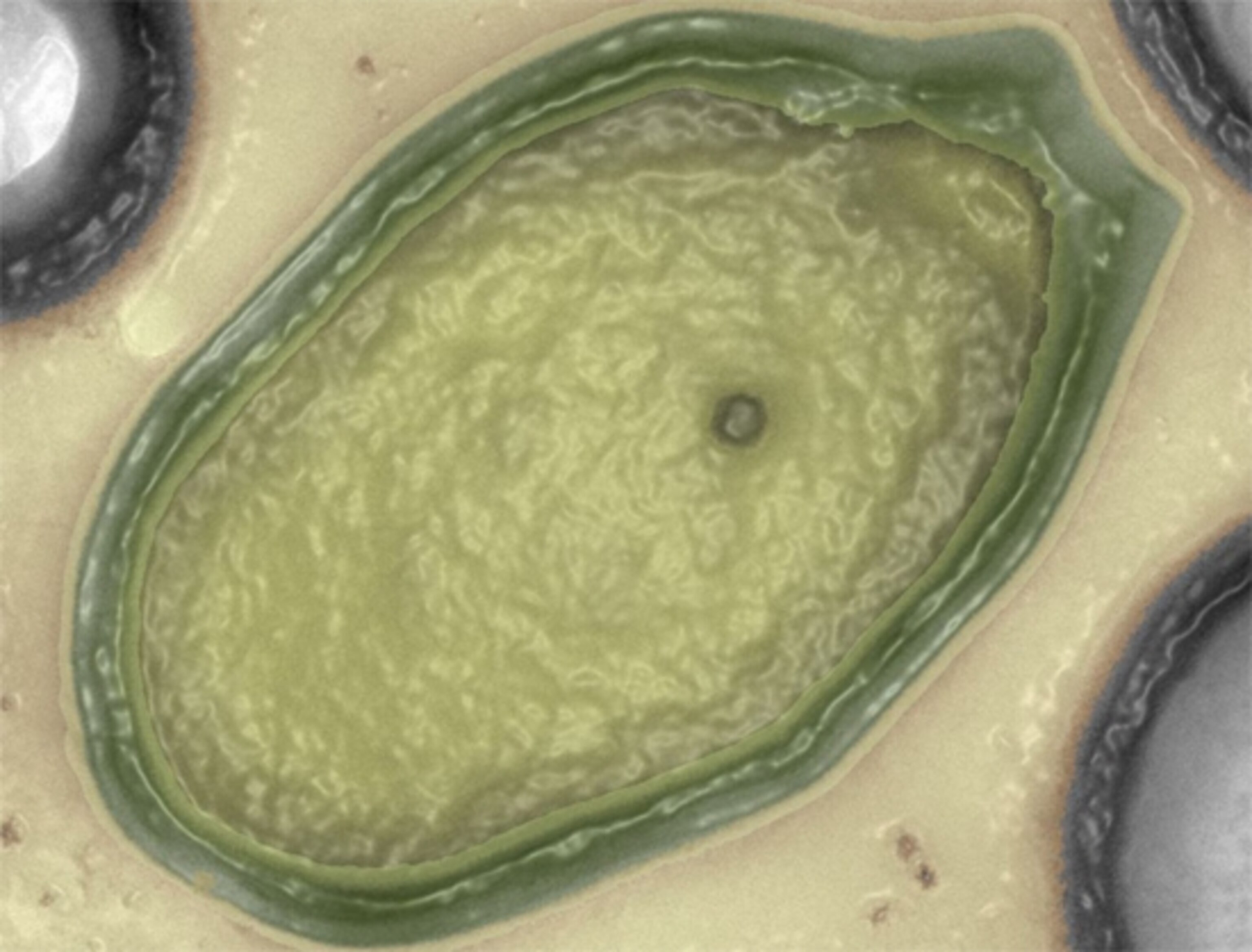 Pandoravirus infecting a cell. Credit: IGS CNRS-AMU)
