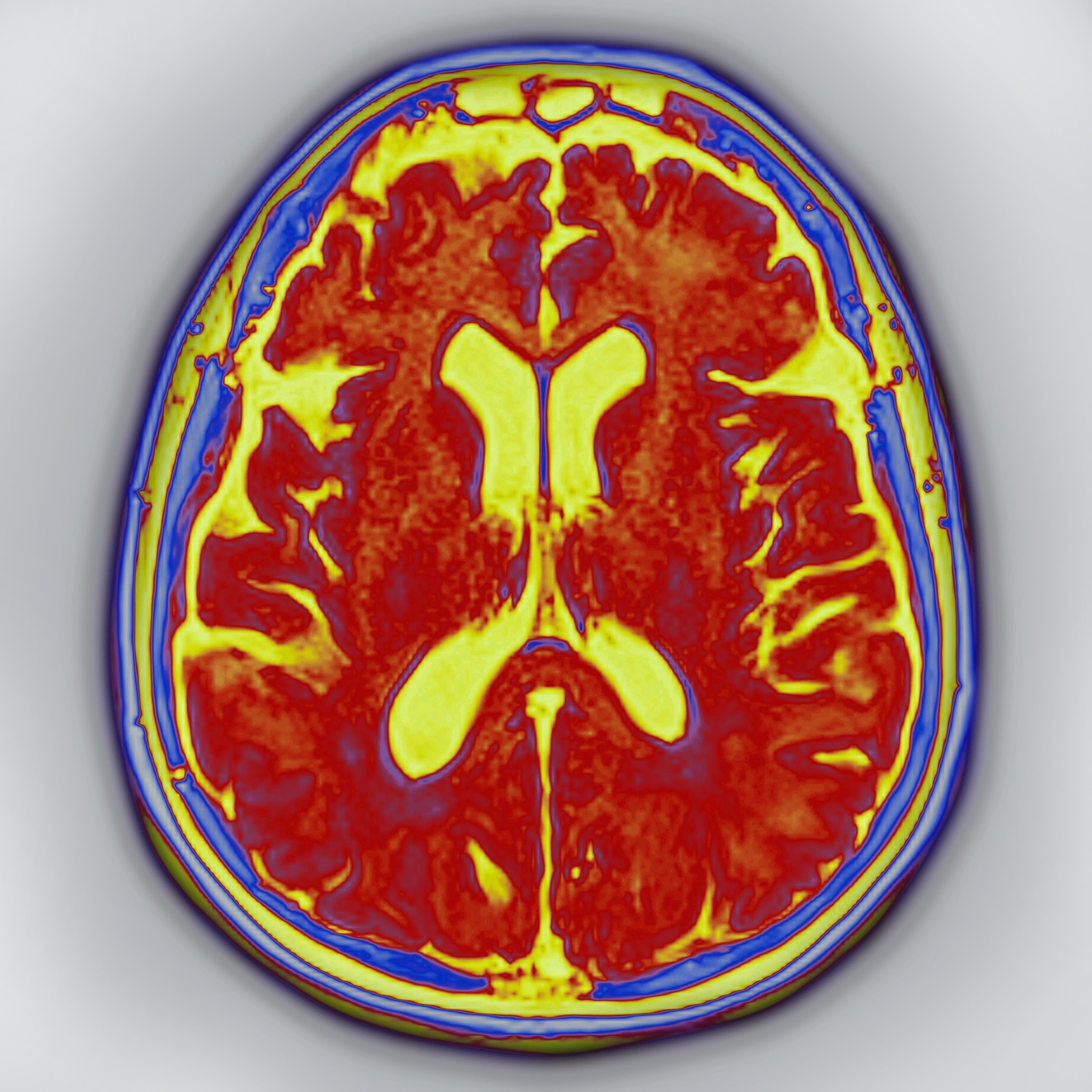 How to take better care of your aging brain