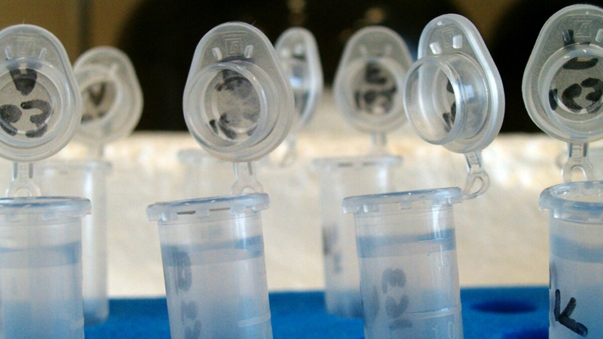 Contaminomics: Why Some Microbiome Studies May Be Wrong | National ...