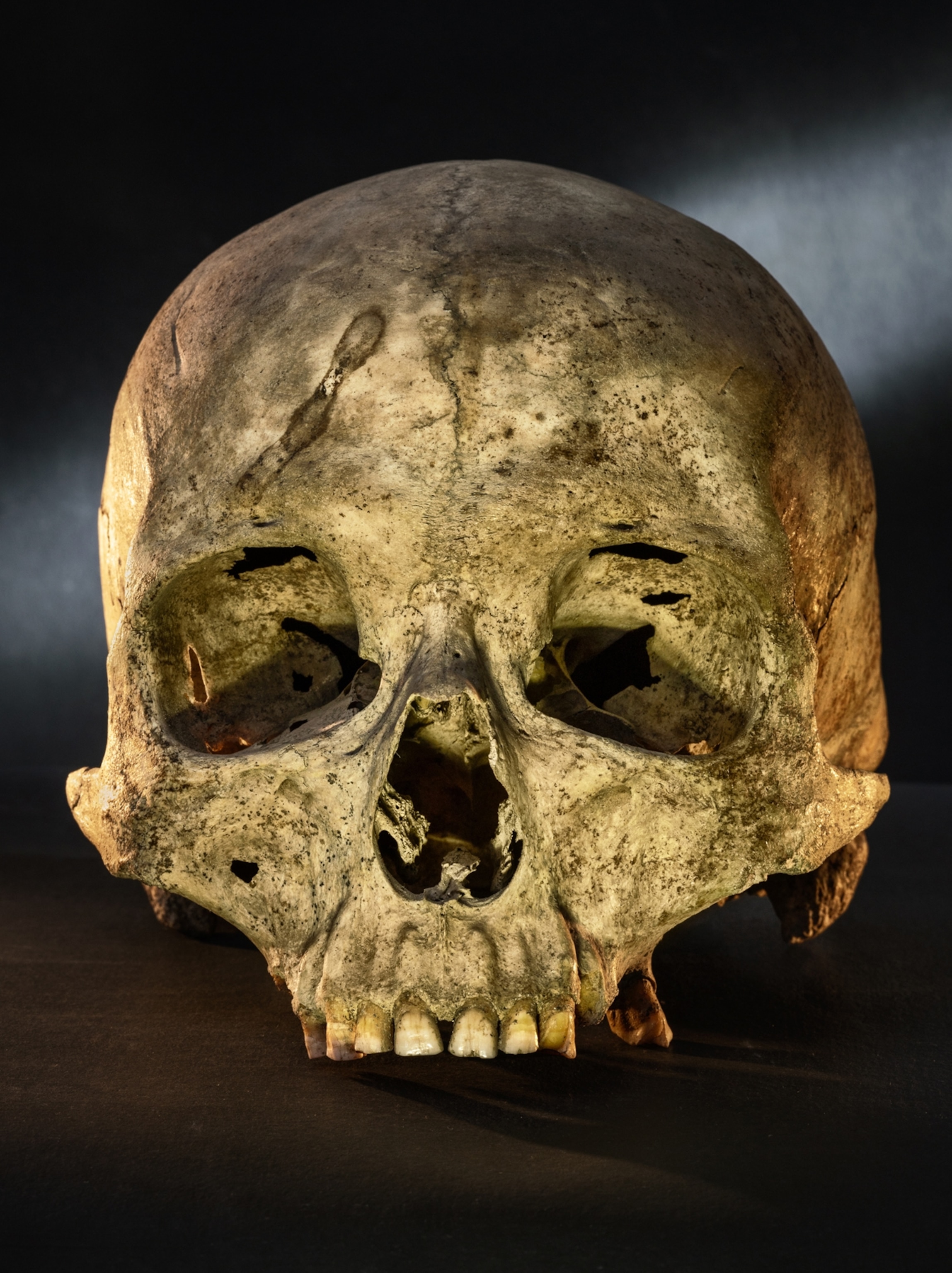 A skull on black background.
