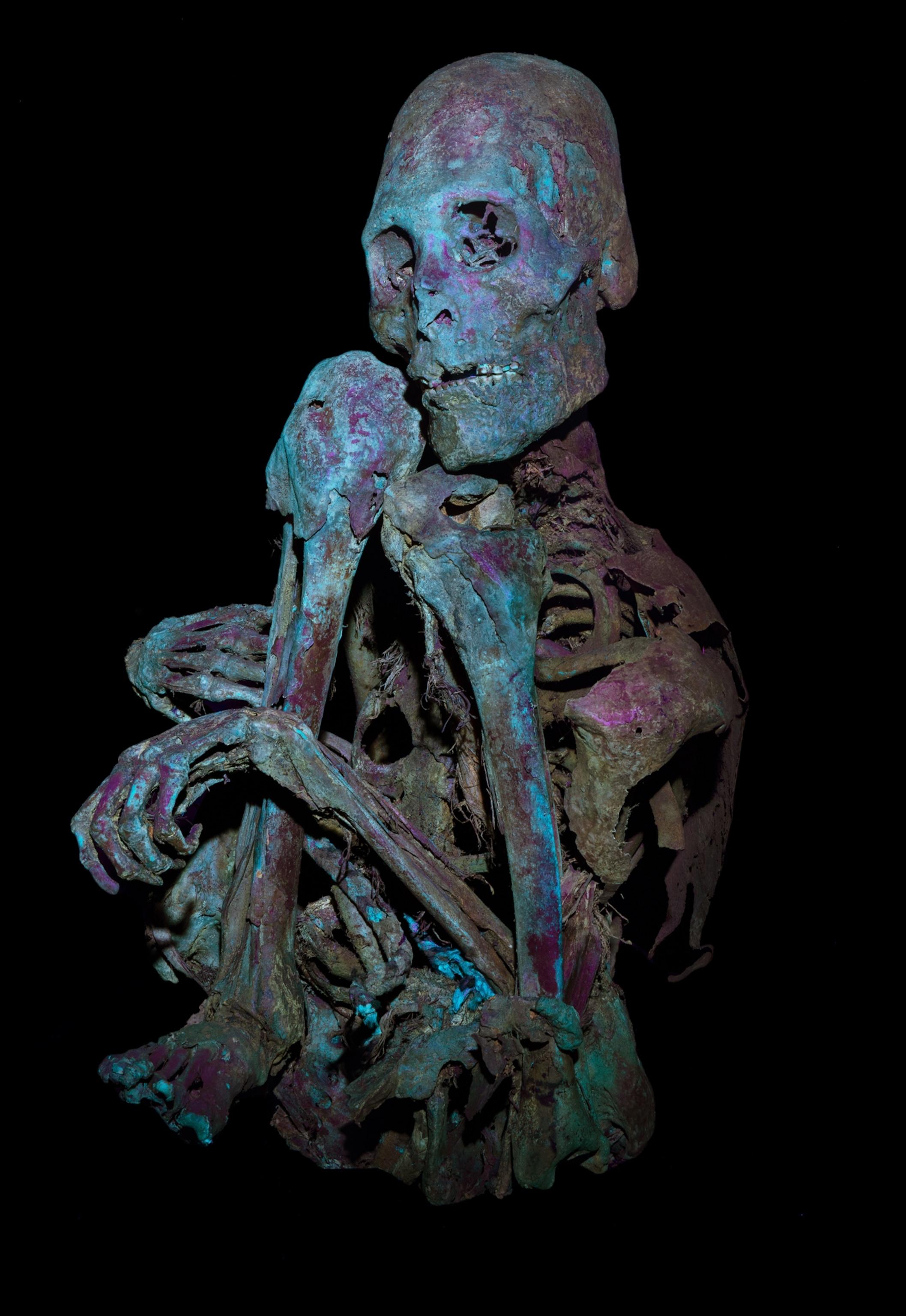 A human mummy is pictured upright in the fetal position, with its knees bent and hitting its chin and its arm wrapped around its legs. The mummy is colored blue and purple and very skeletal but still has connective tissue intact, keeping its body together.