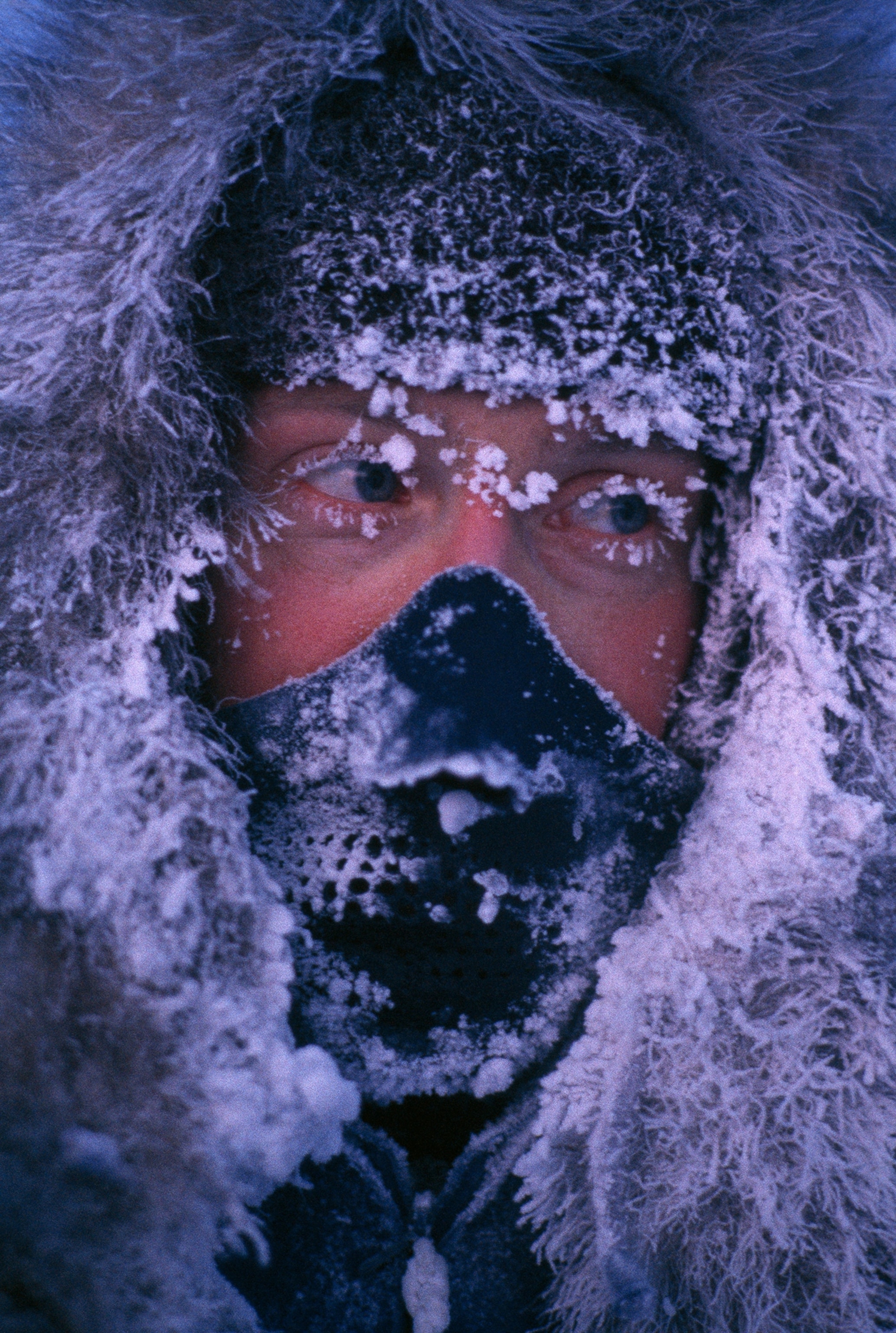 An explorer's face is encrusted in ice