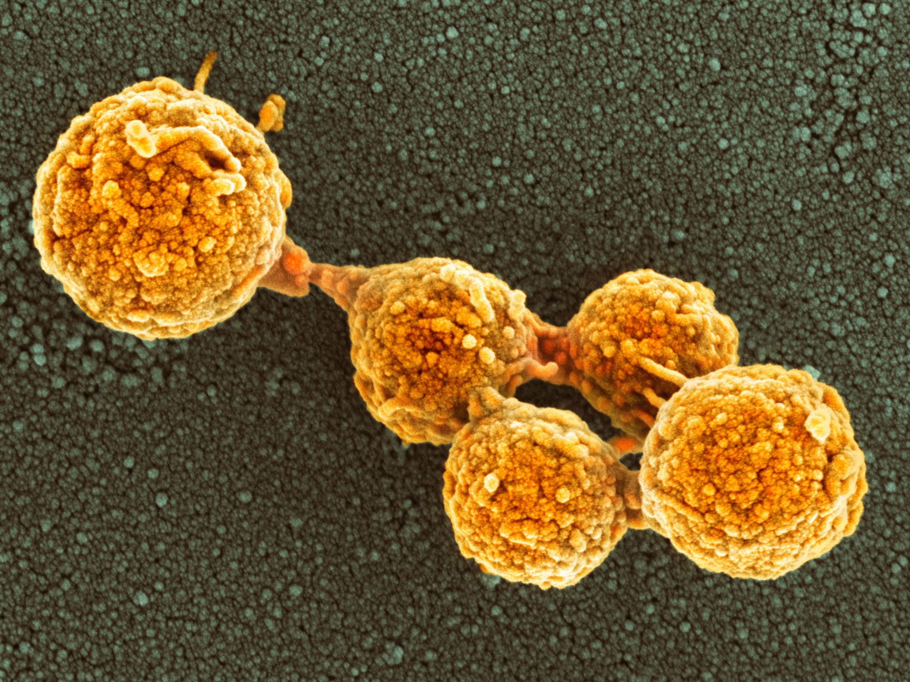 A micrographic view of a cluster of round cells