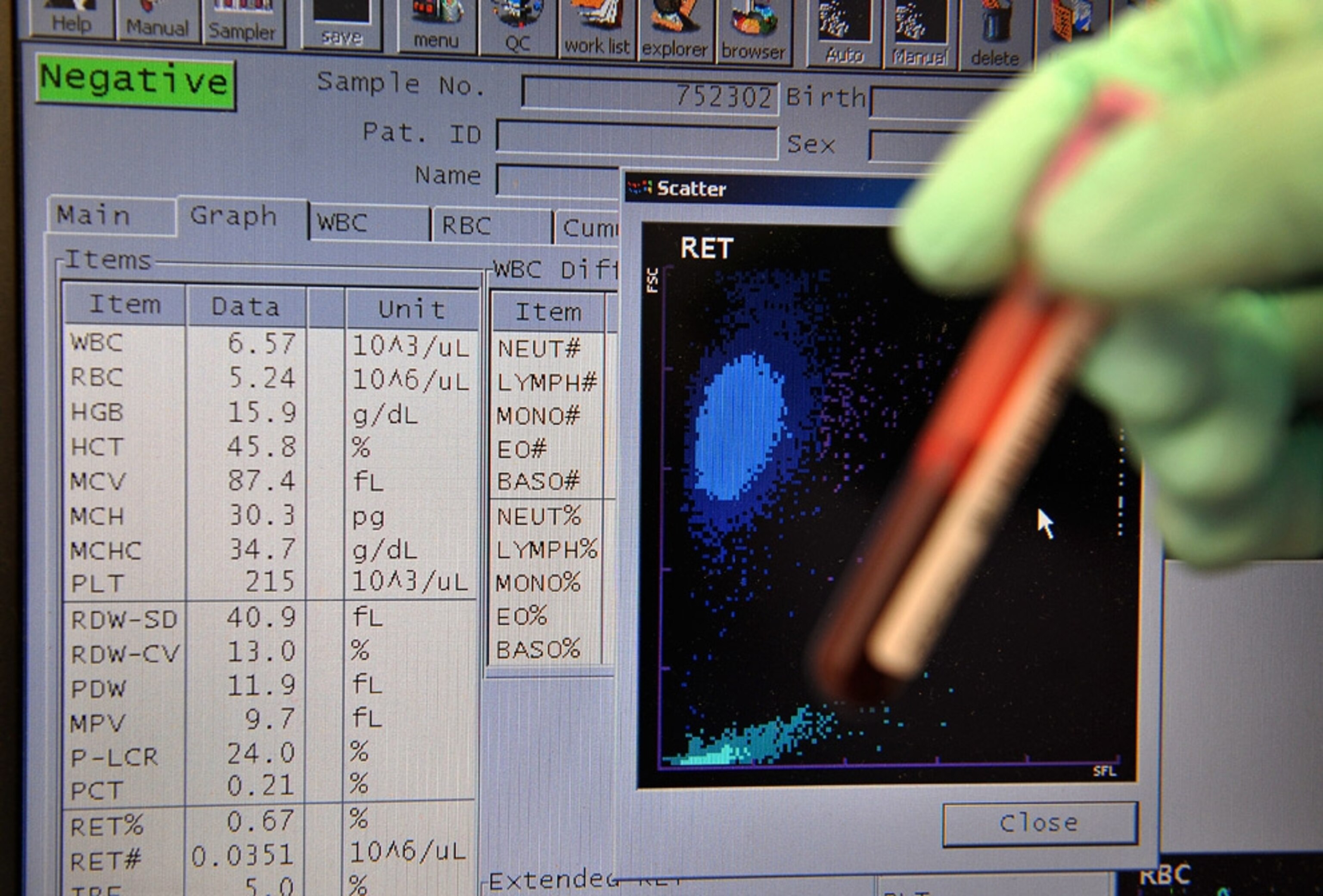 Swiss Laboratory for Doping Analysis' Neil Robinson displays the results of a blood sample test in Epalinges near Lausanne on February 25, 2009