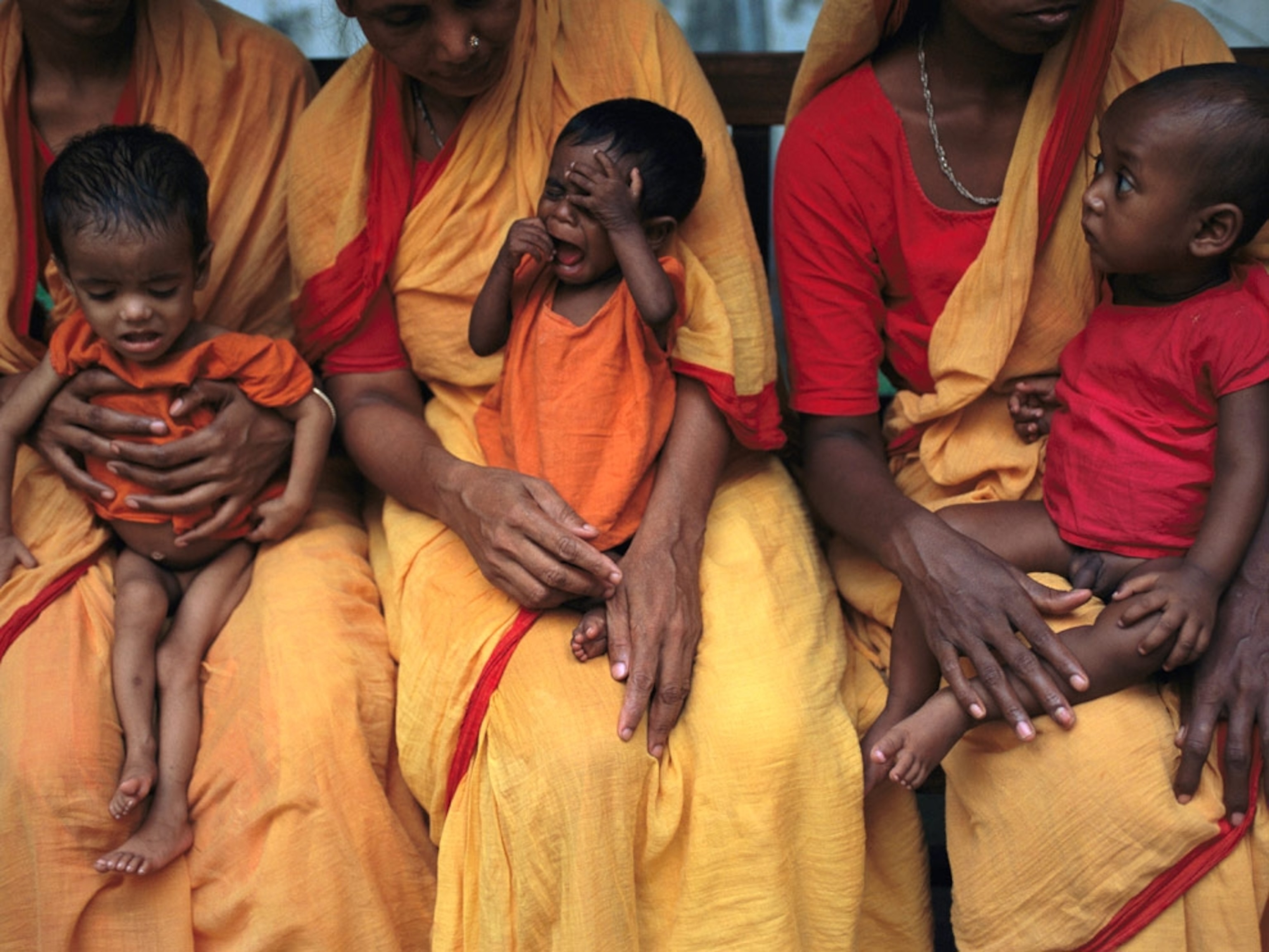 Malnourished children in Dhaka, India