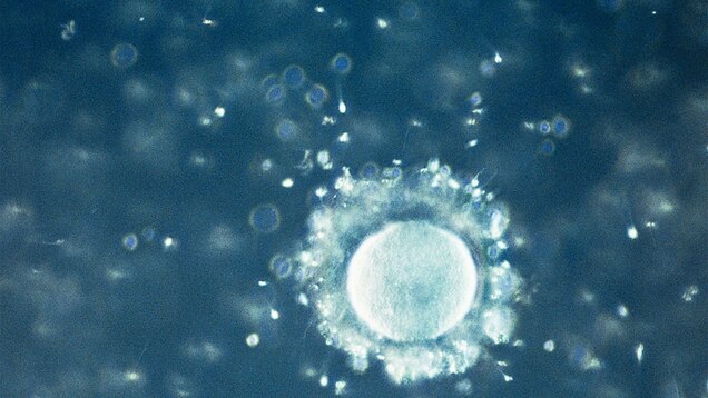 Featured image of post What Does A Human Egg Look Like Outside The Body