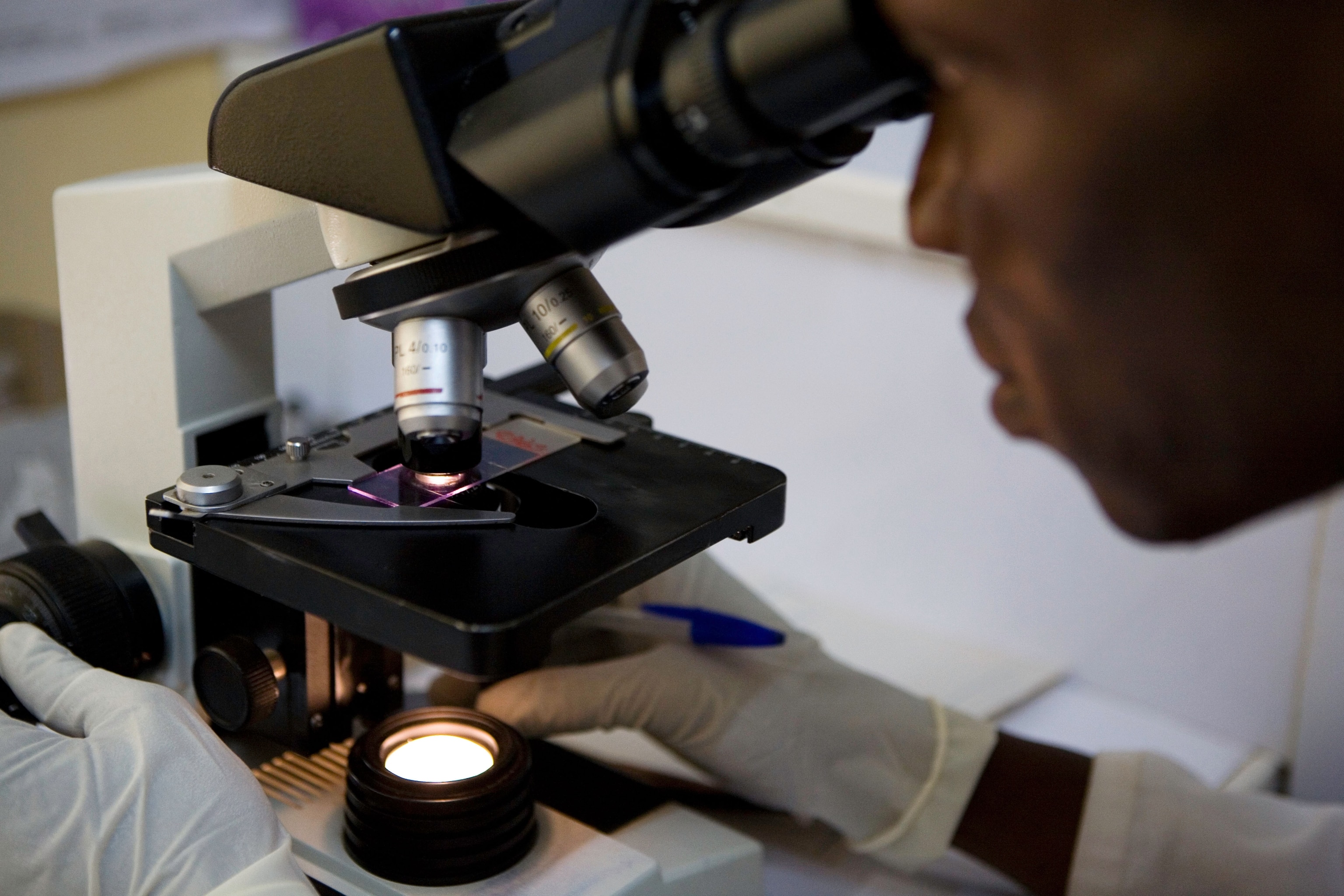 Laboratory technician looks through a microscope, searching through samples of blood for Malaria.