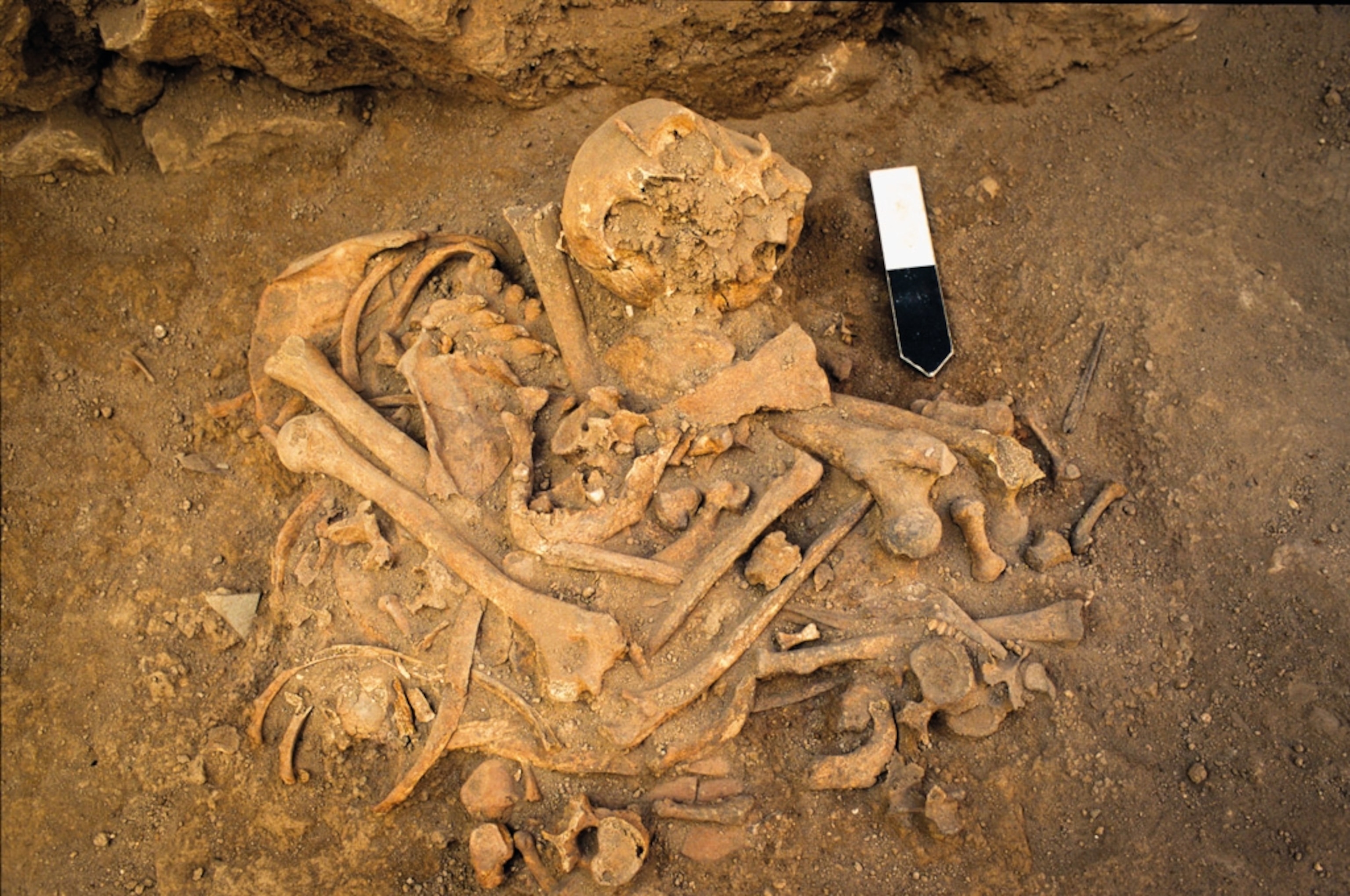 Disarticulated remains of an adult female are pictured.