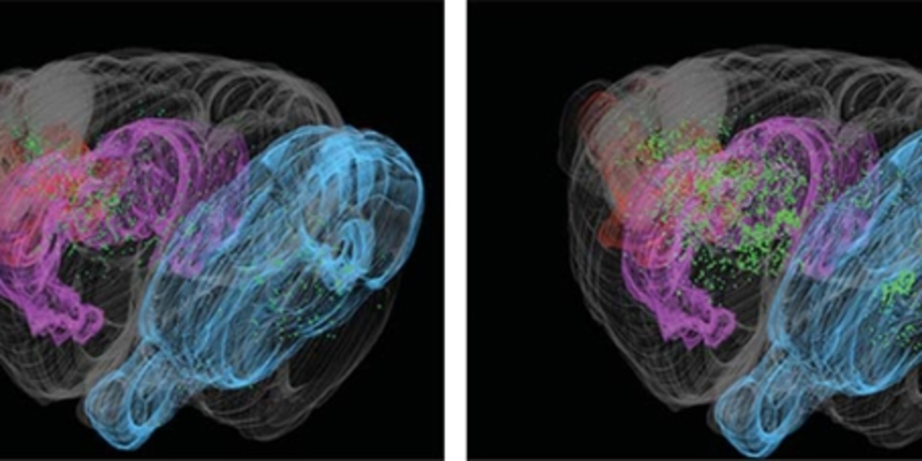 Epilepsy Rett Jumping genes mobilise in the brains of people with Rett syndrome