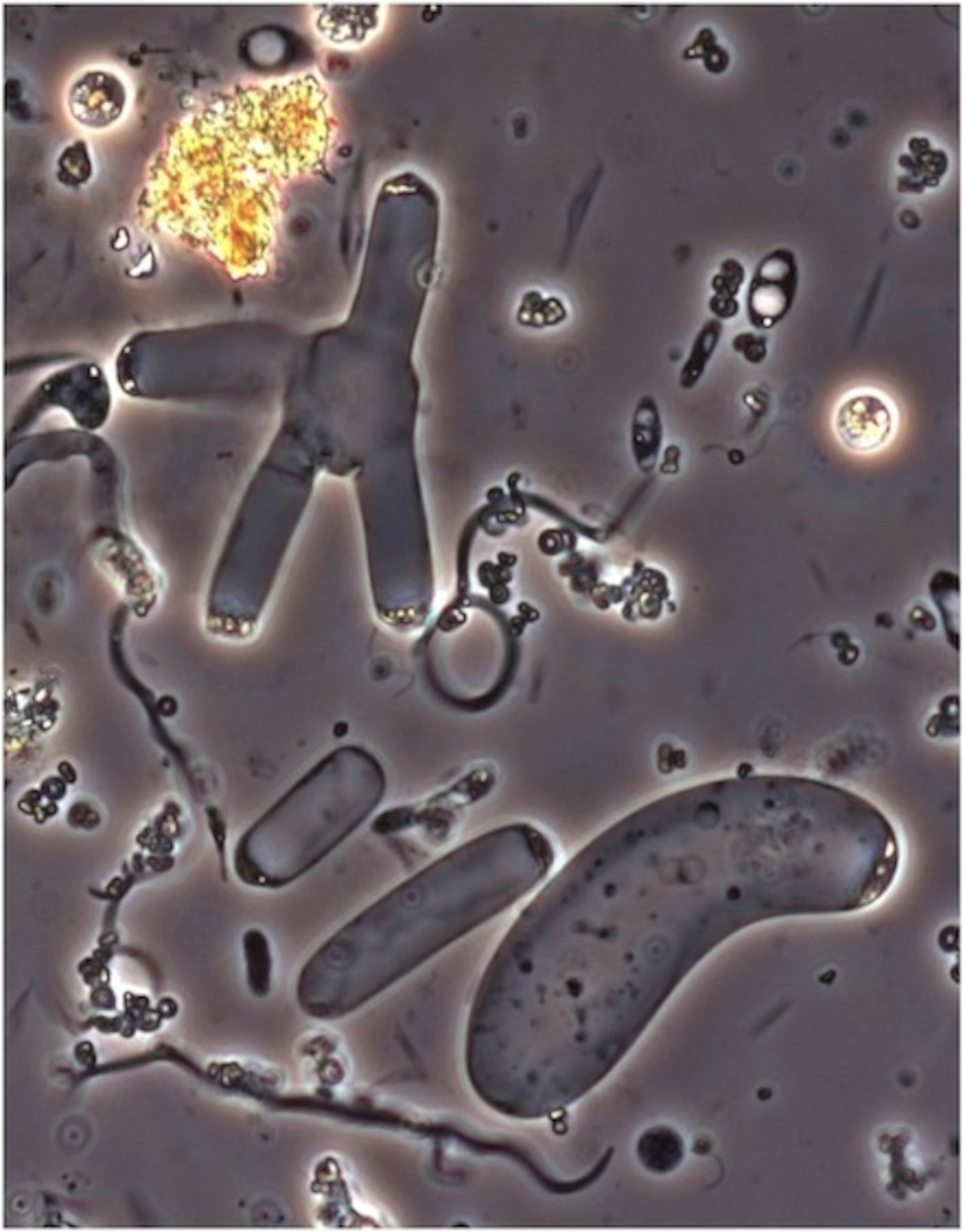 Malaria, Sea Grapes, and Kidney Stones A Tale of Parasites Lost