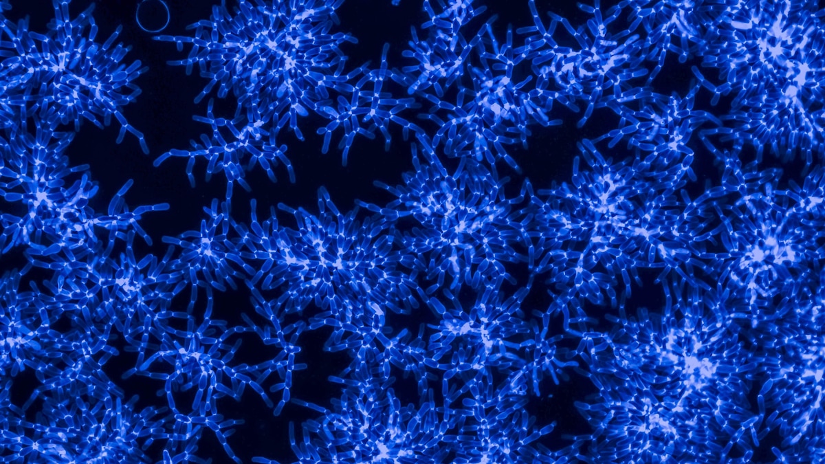 Evolving globs of yeast may unlock mysteries of multicellular life Evolving globs of yeast may unlock mysteries of multicellular life