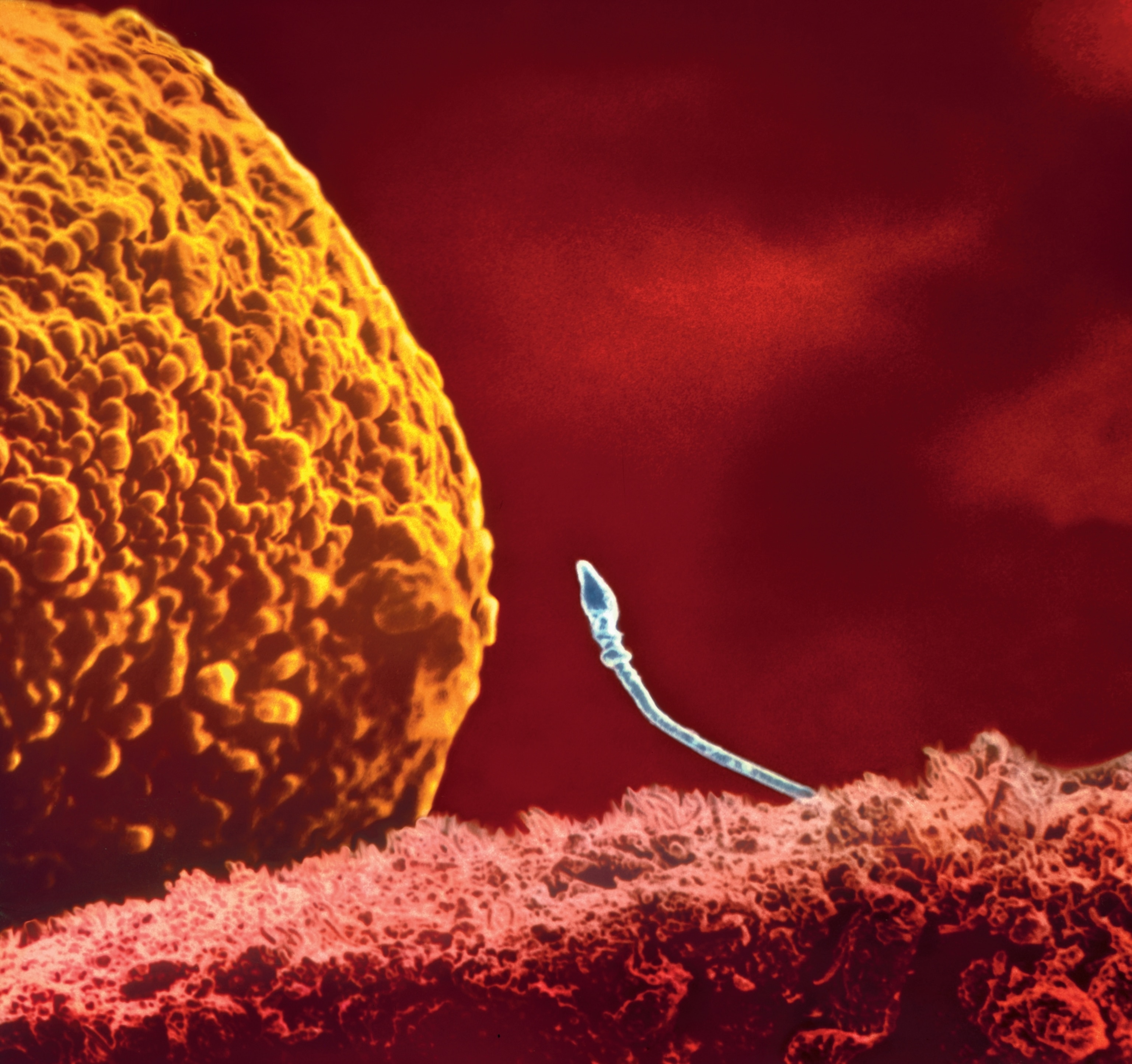 A colorized scanning electron micrographic view of a single sperm before a relatively enormous human egg