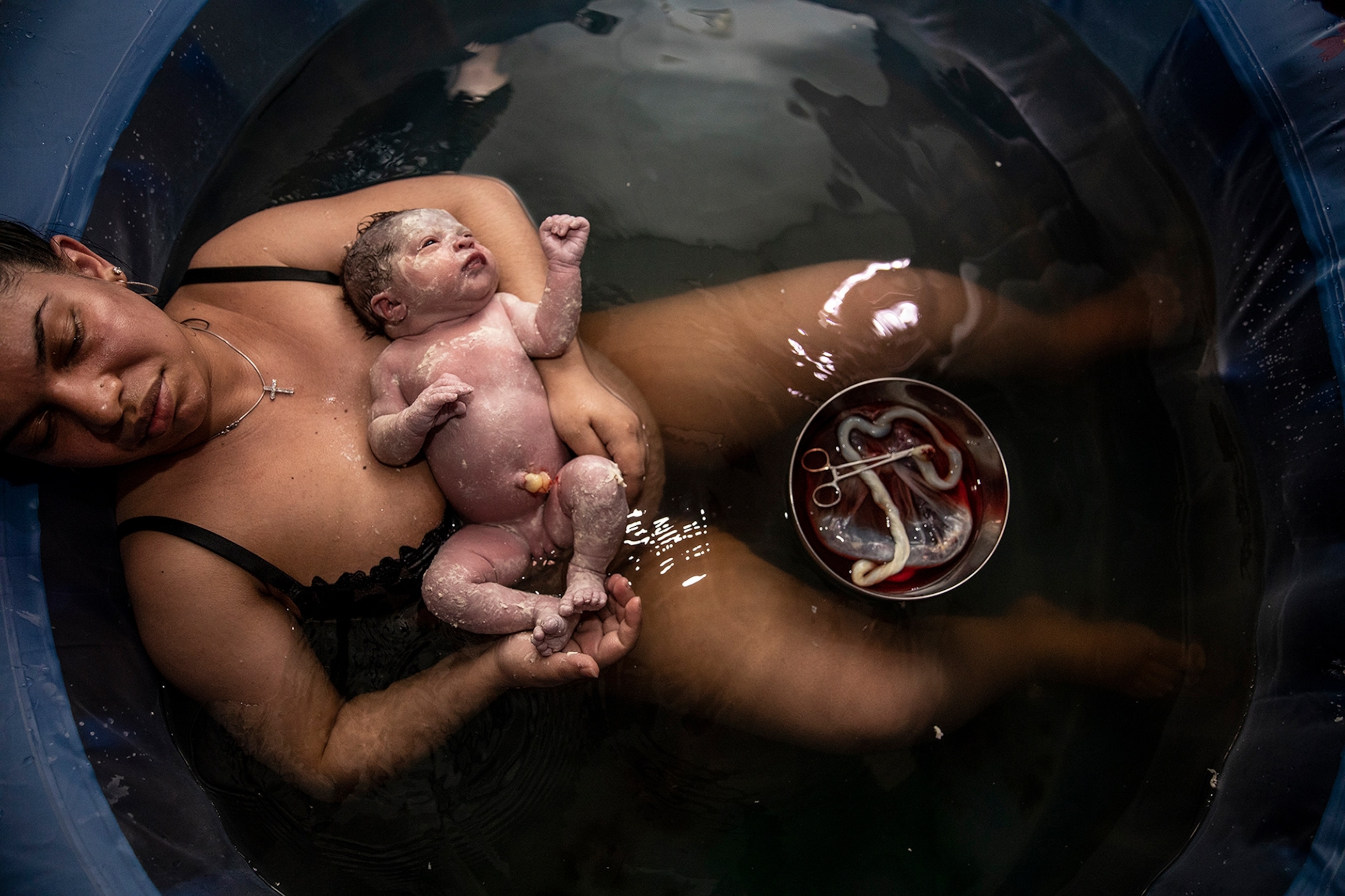 resting woman with baby in her hands and placenta in tray between her legs.