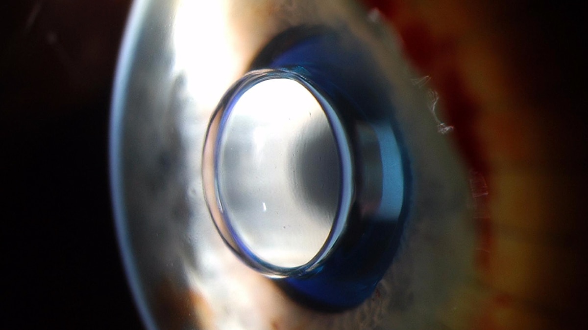 Repairing and Replacing Body Parts What's Next