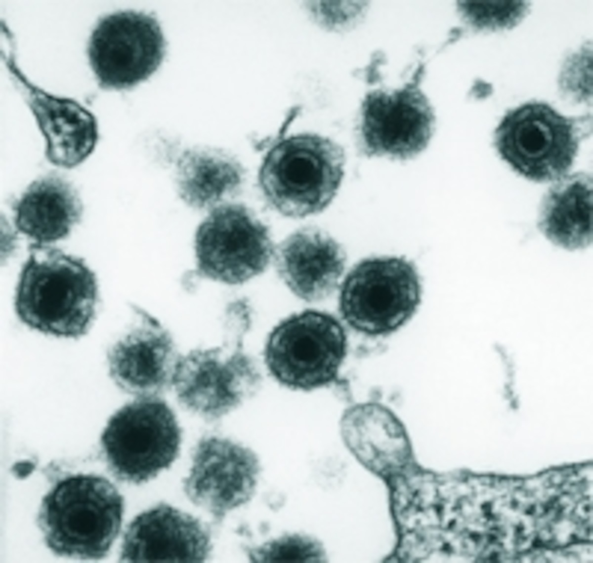 Dormant viruses can hide in our DNA and be passed from parent to child