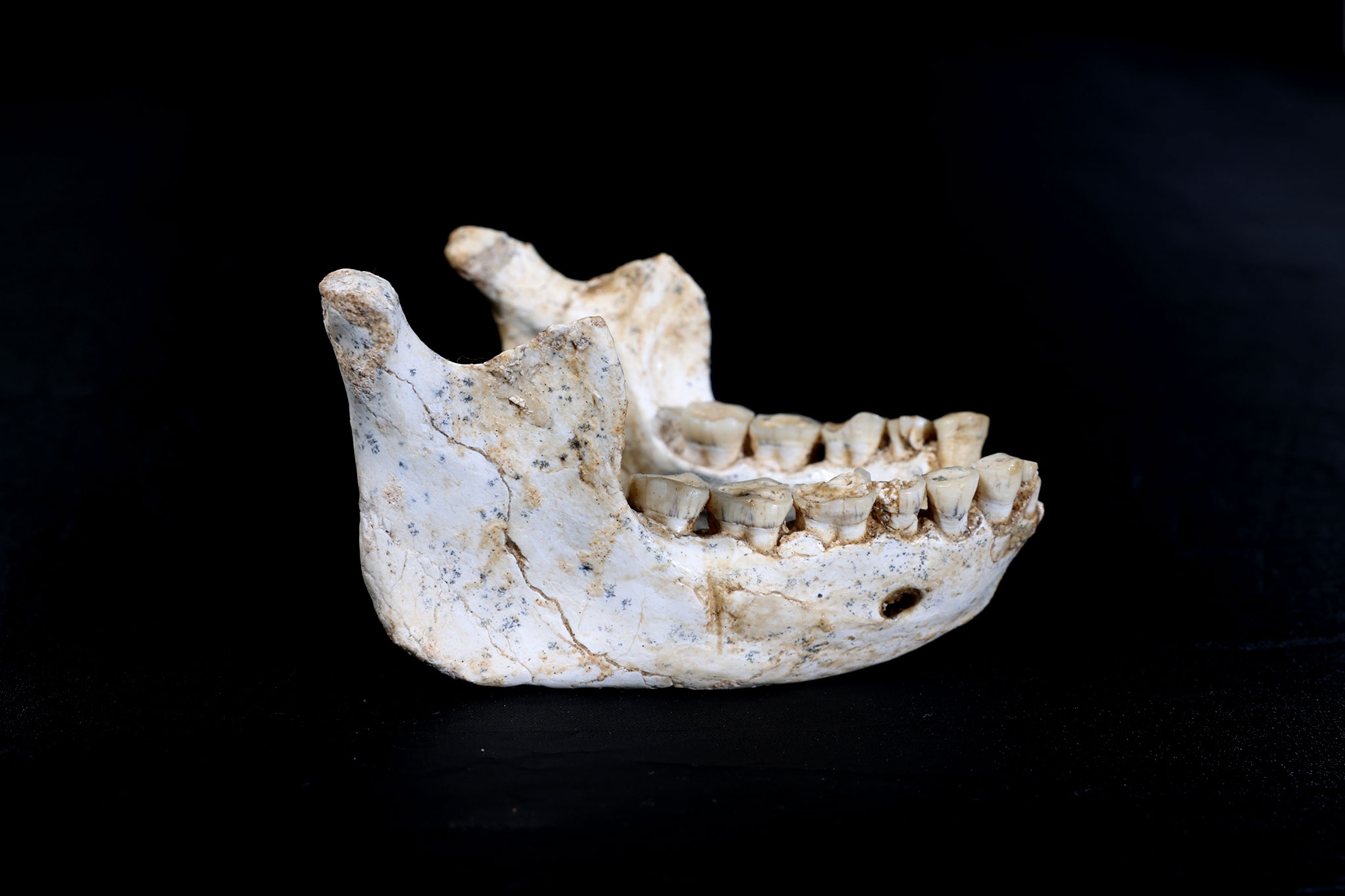 A bone with teeth on a black background.