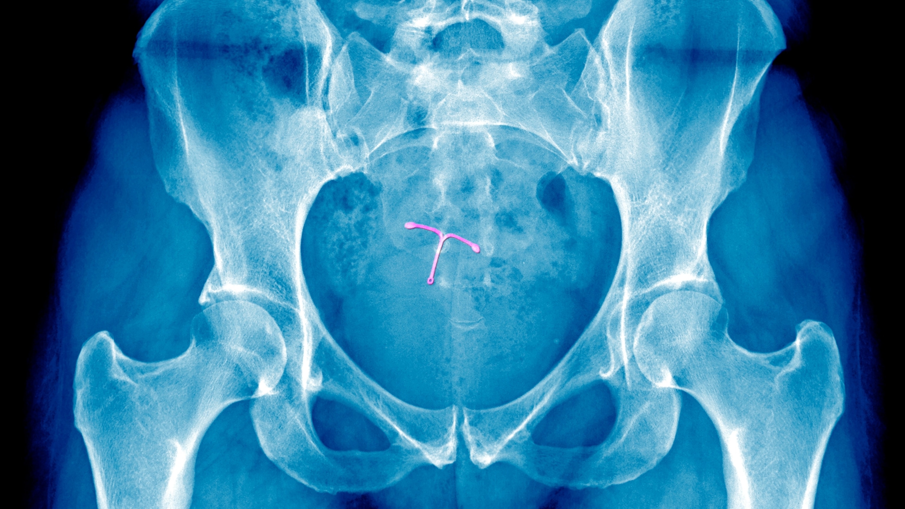 Doctors are starting to take women’s pain more seriously