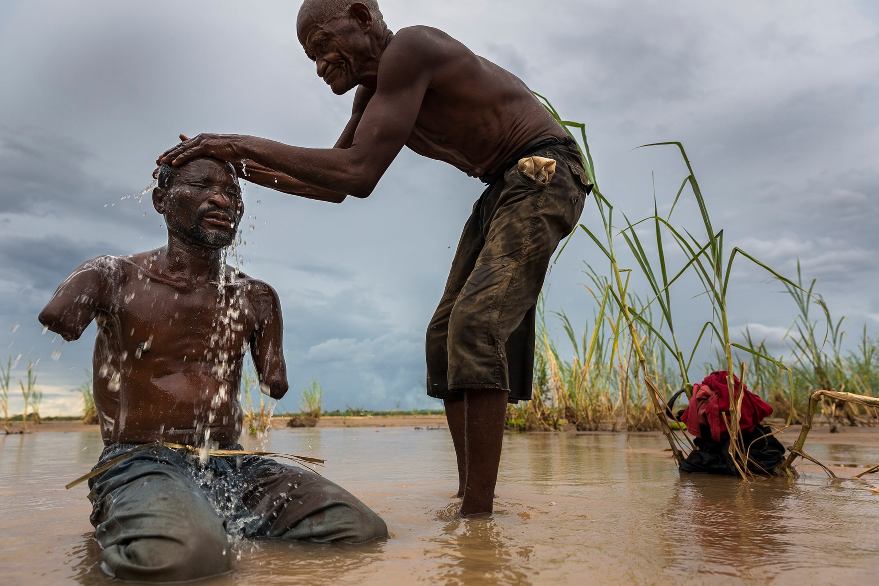 Yusuf Shabani Difika, 41, lost both his arms to a lion attack on a fishing trip in the region of Selous National Park, Tanzania, 4 March 2013. The attack occured in the evening in 2005.