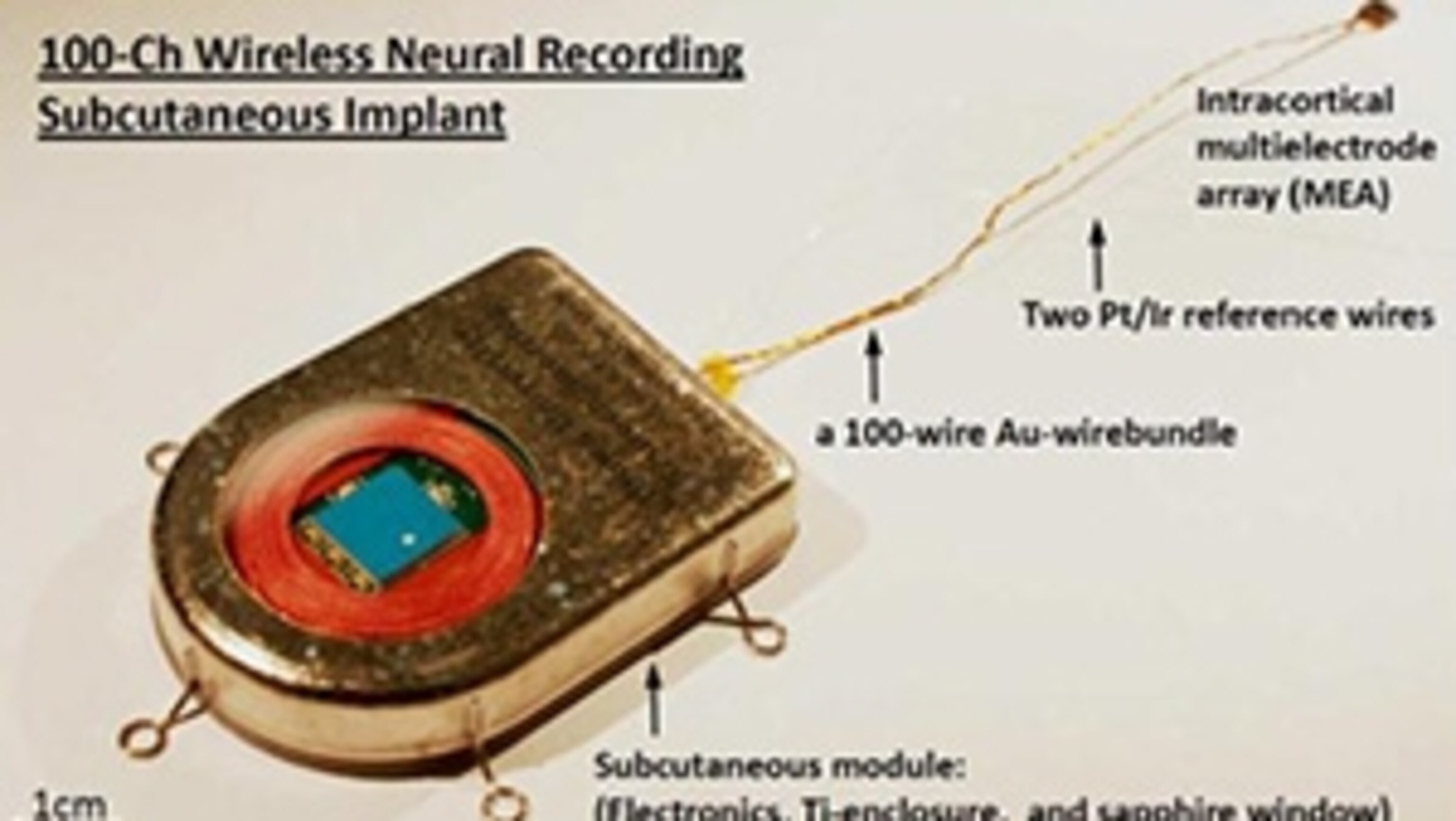 Yin et al IEEE Trans Biomed Circuits Syst. Apr 2013; 7(2): 115–128. doi: 10.1109/TBCAS.2013.2255874