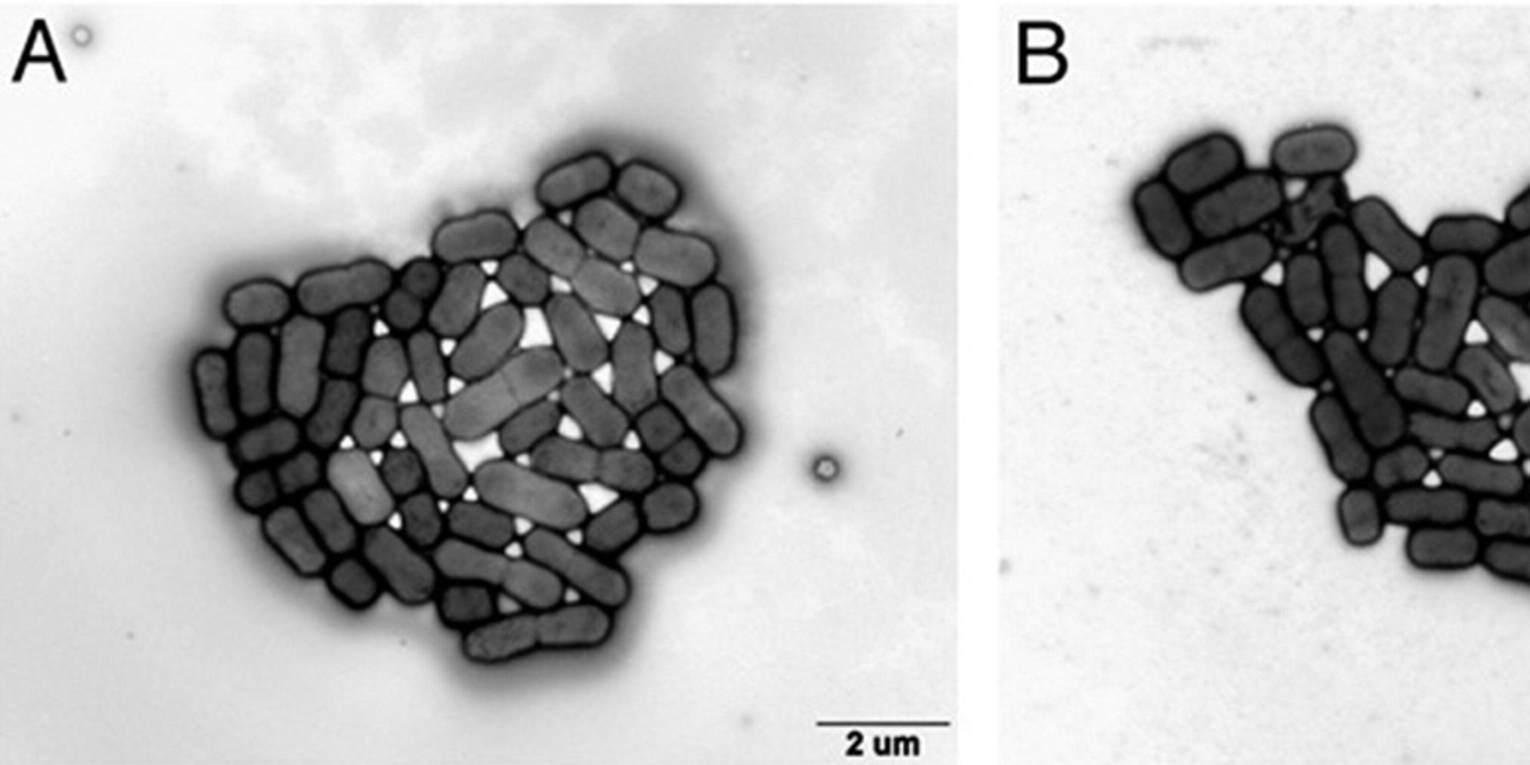 Bacteria Grow Under 400,000 Times Earth's Gravity