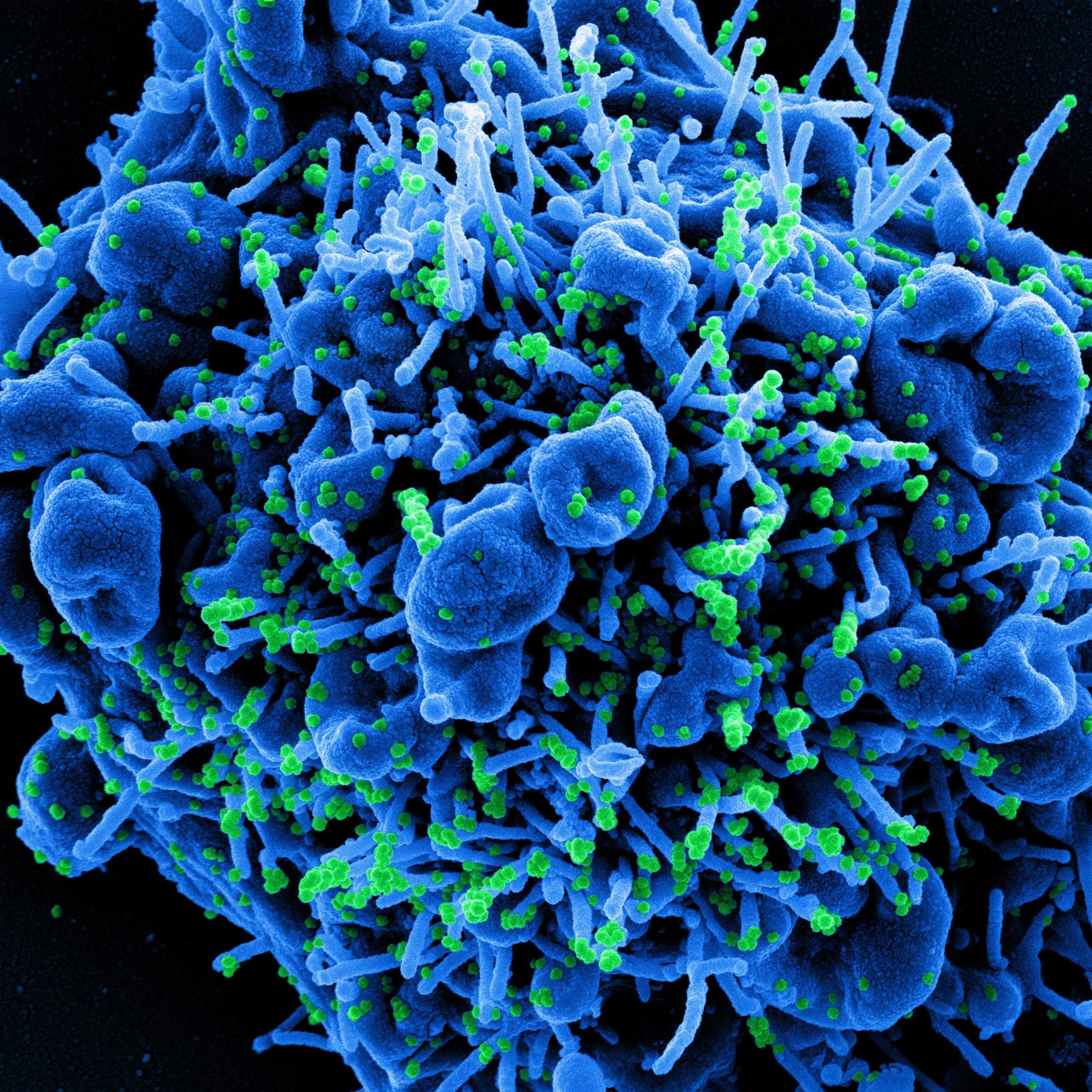 The Coronavirus Is Mutating But What Determines How Quickly