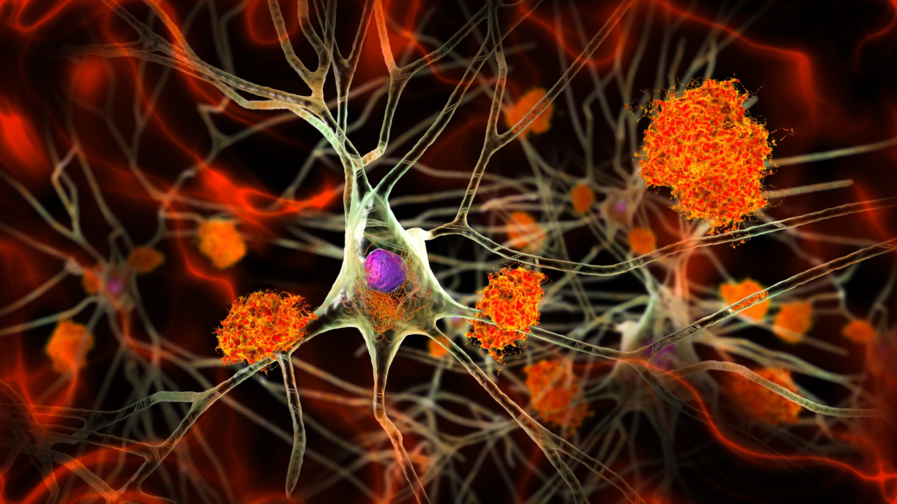 illustration of neurons with vibrant orange clusters of plaque