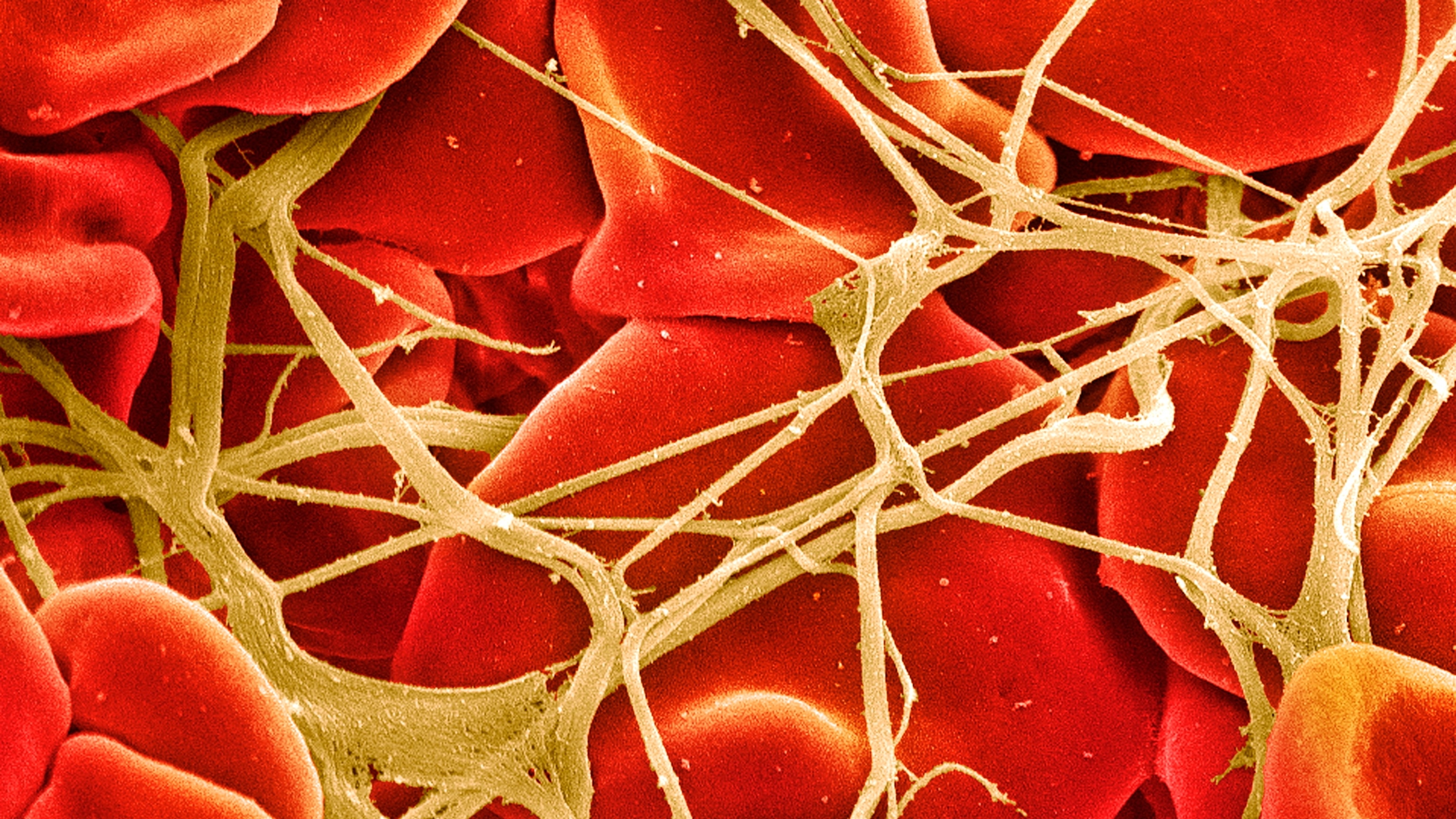 The Breakthrough Drugs Transforming Hemophilia Care