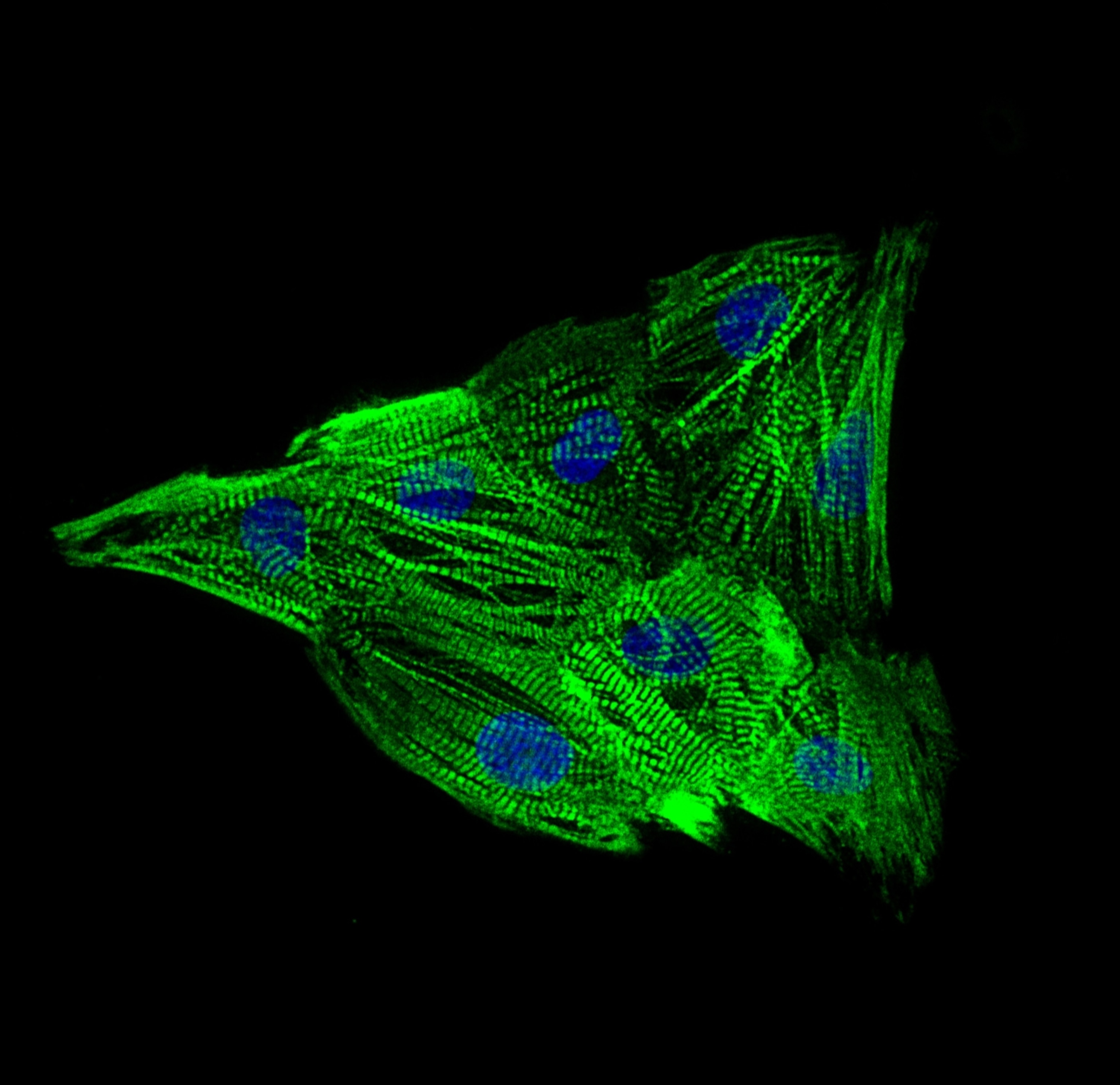 A series of bright green lines forming a triangular shape.