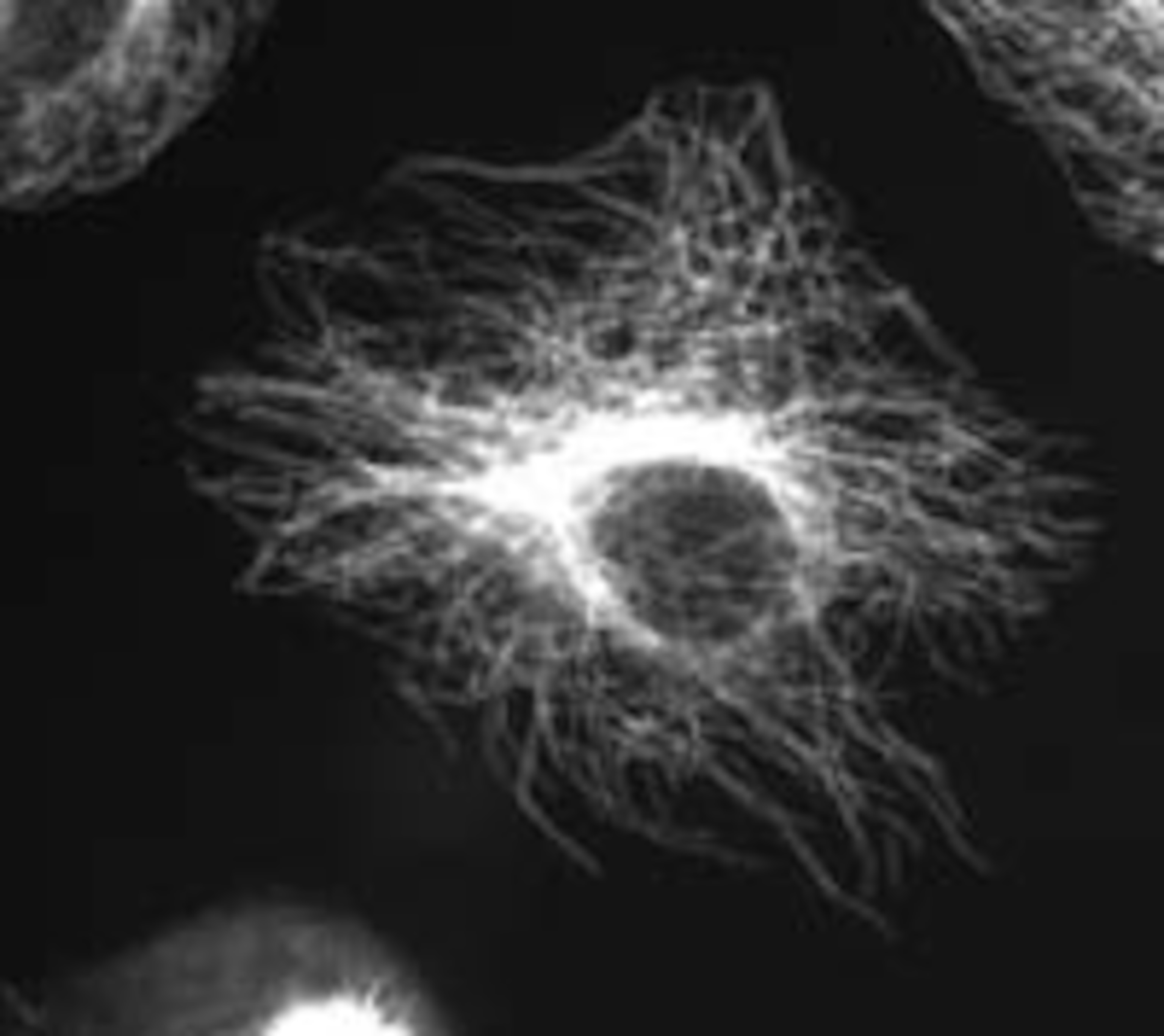 microtutubules_gel_fixated.jpg