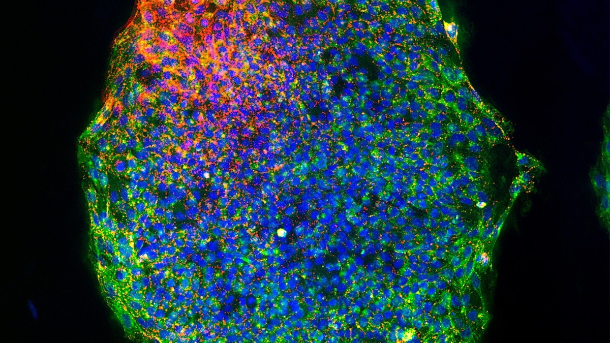 Are We on the Brink of Ending Aging?
