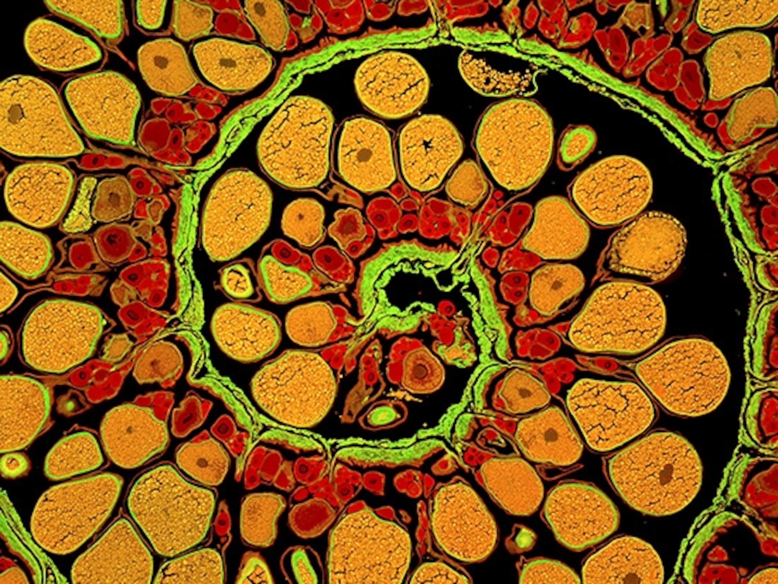 James E. Hayden, The Wistar Institute, Philadelphia, Pa.