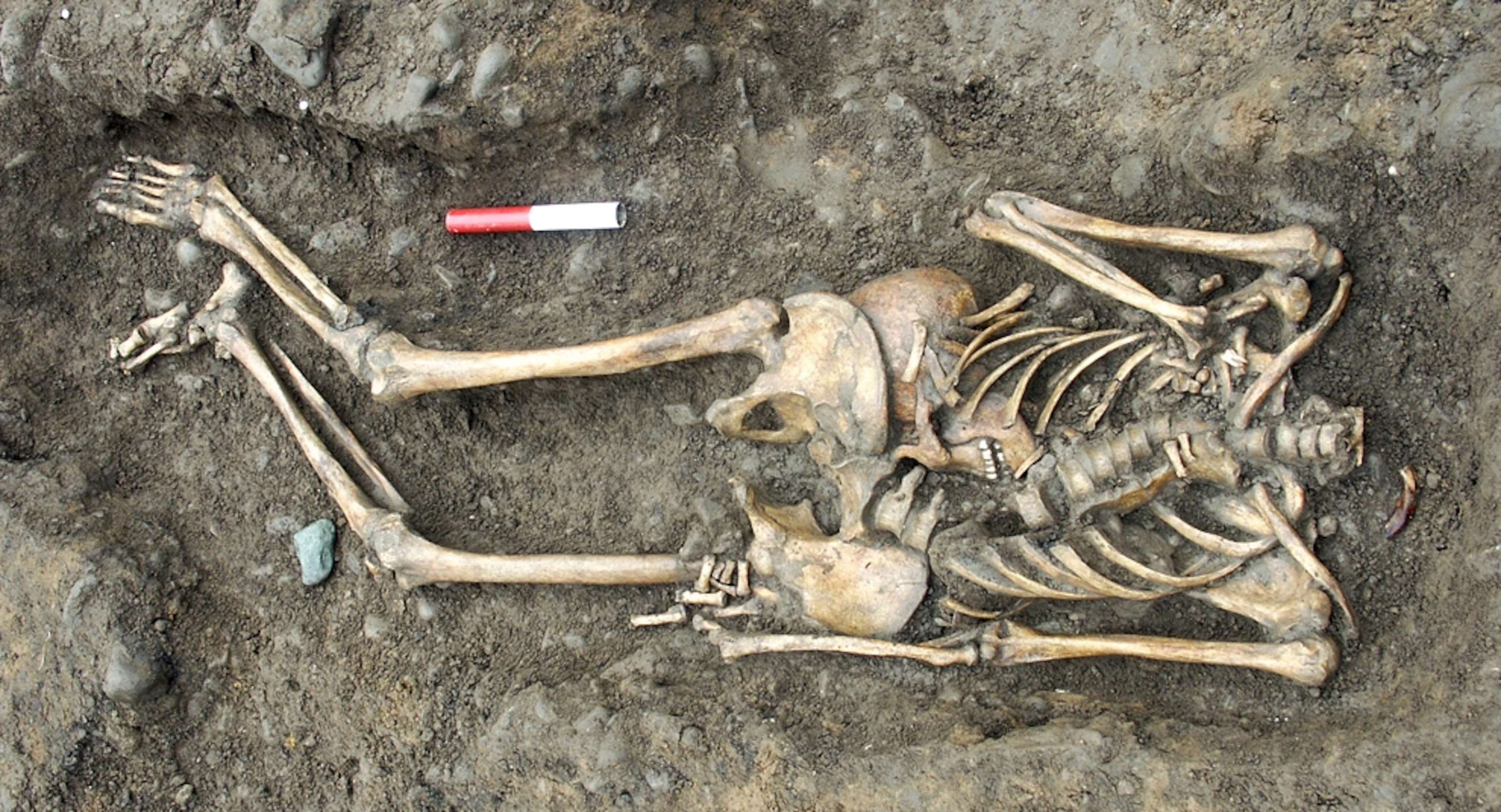 A headless skeleton.