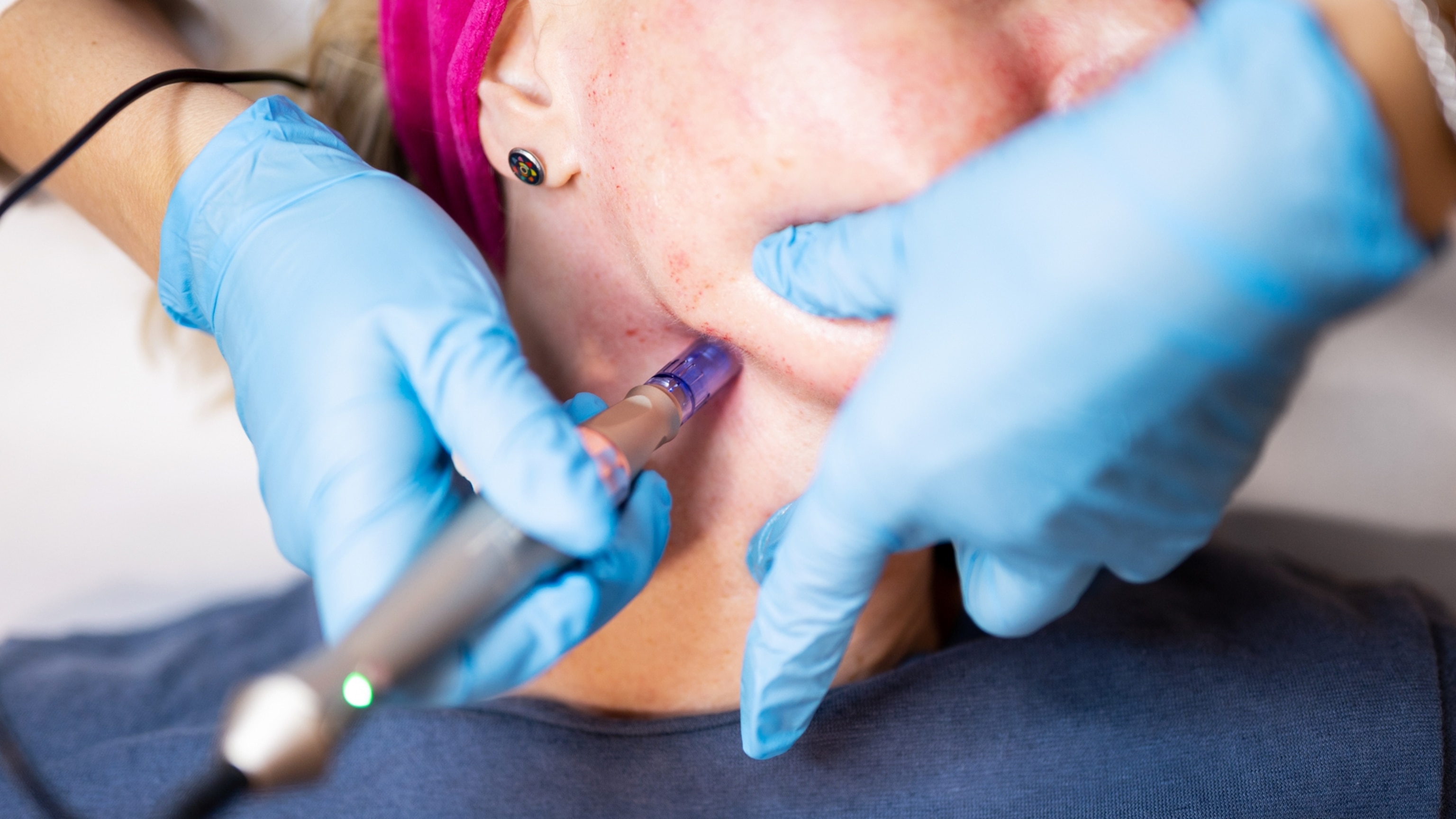 The real science of exosomes—the latest obsession in skincare